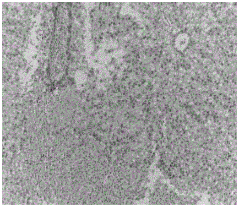 Composite feed capable of protecting liver health of tilapia and preparation method of composite feed