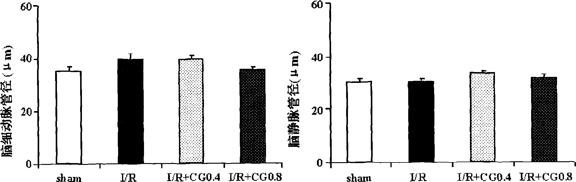 Improvement effect of blood-nourishing and brain-refreshing granules on cerebral microcirculatory disturbance