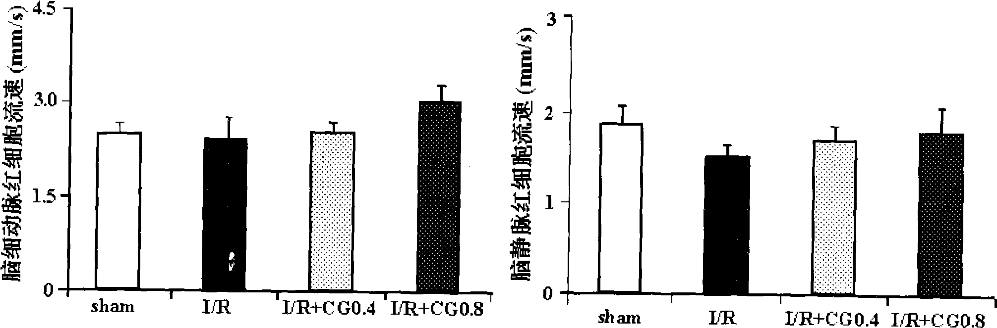 Improvement effect of blood-nourishing and brain-refreshing granules on cerebral microcirculatory disturbance