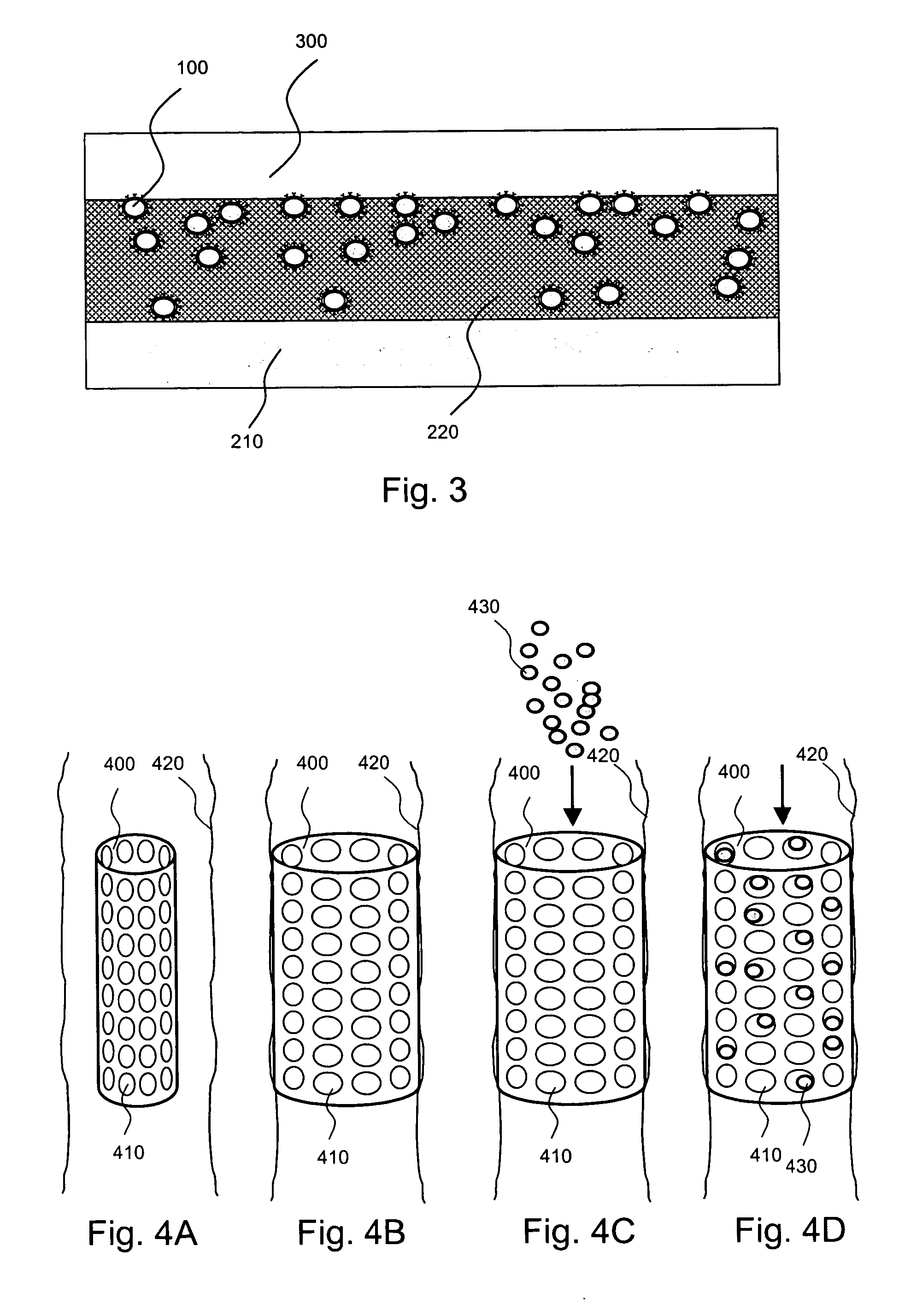 Localized drug delivery using drug-loaded nanocapsules