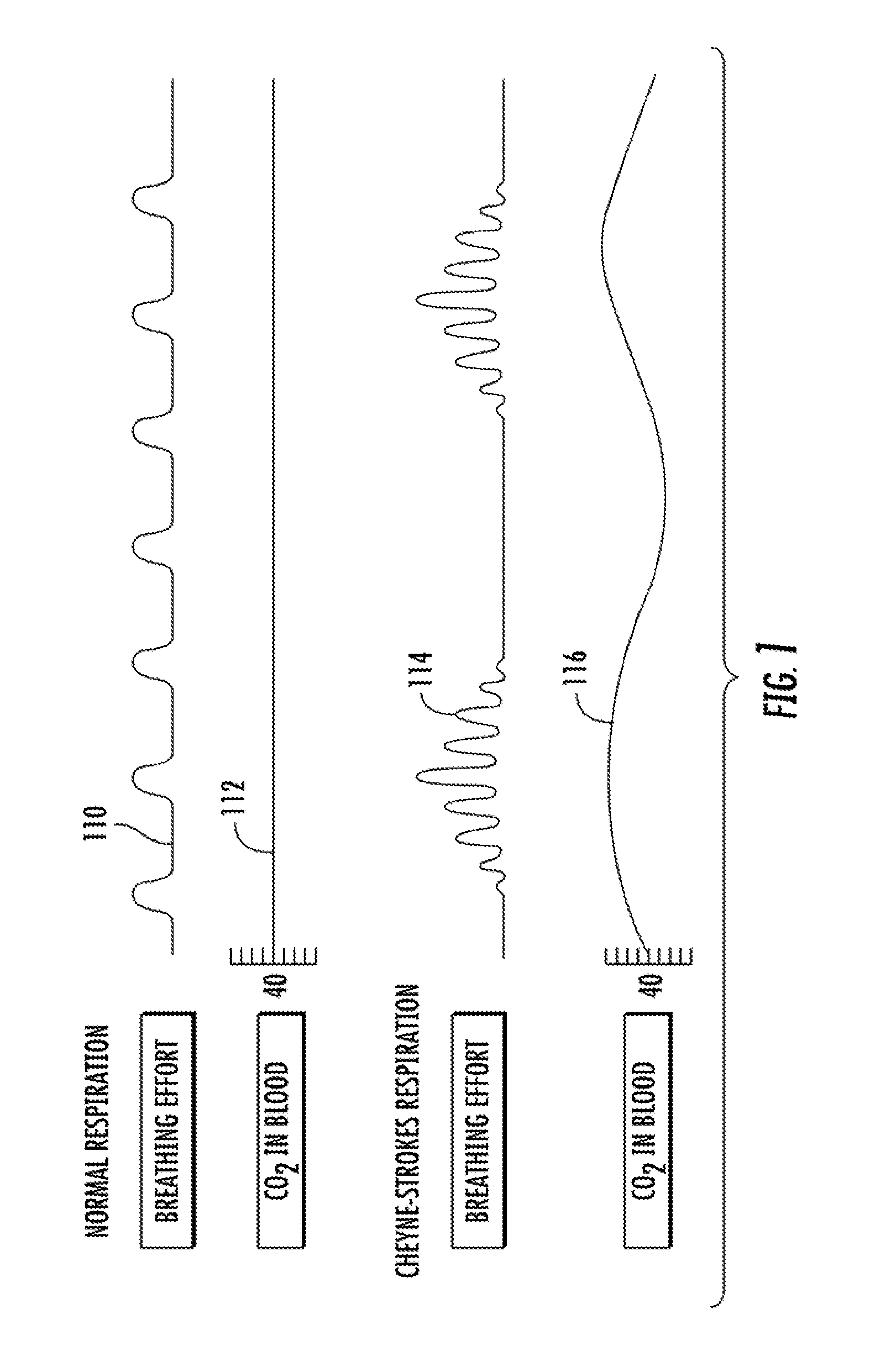 Respiratory tubing set