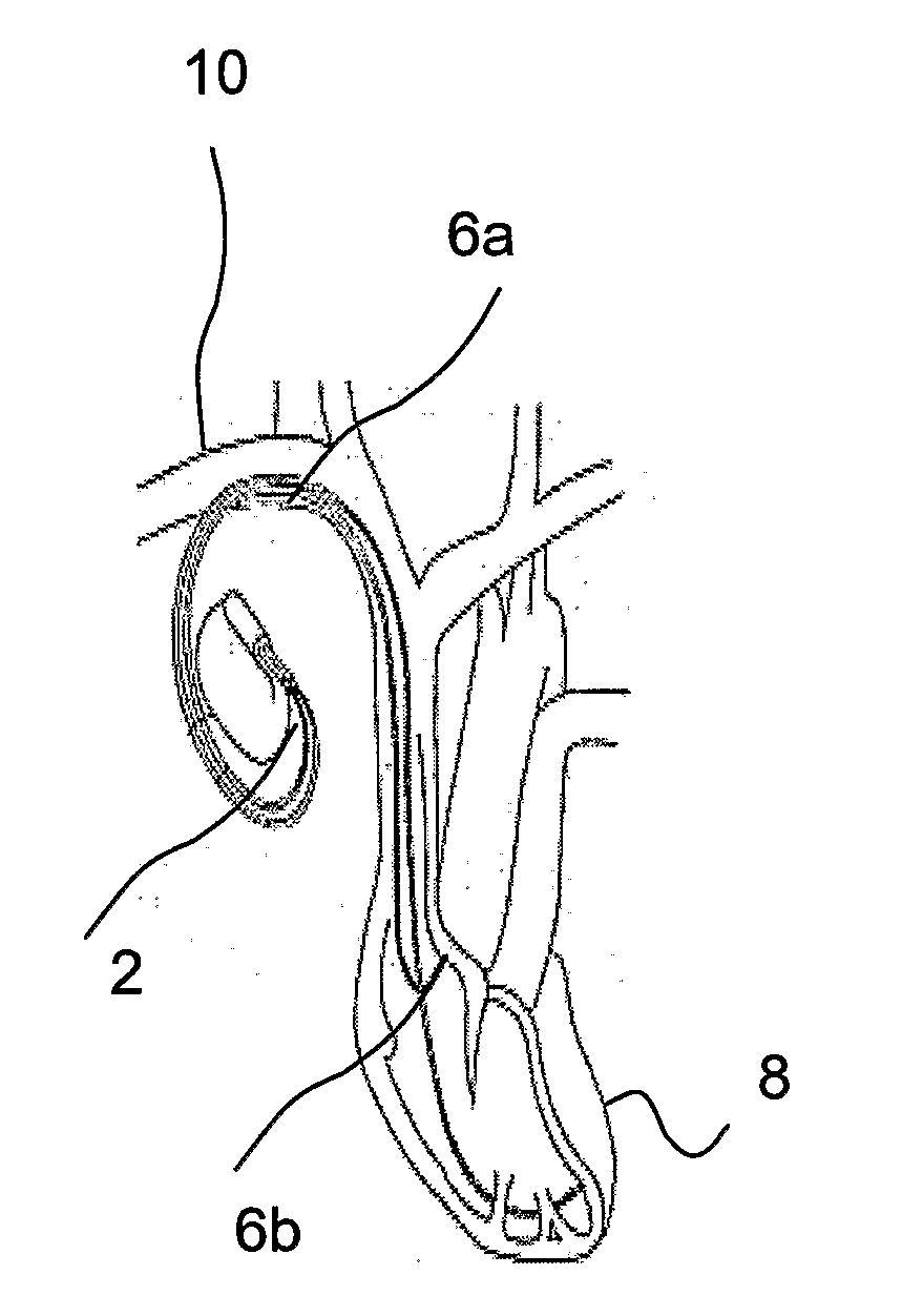 Method, Device and Computer-Readable Medium for Evaluating Prevalence of Different Patient Postures