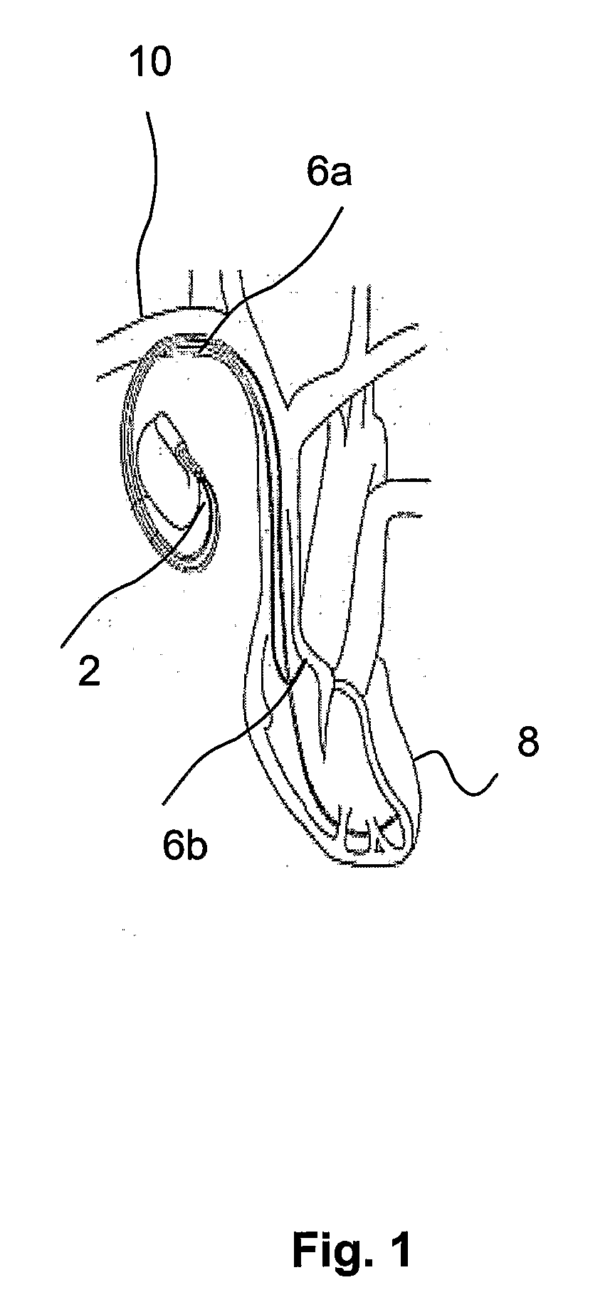 Method, Device and Computer-Readable Medium for Evaluating Prevalence of Different Patient Postures