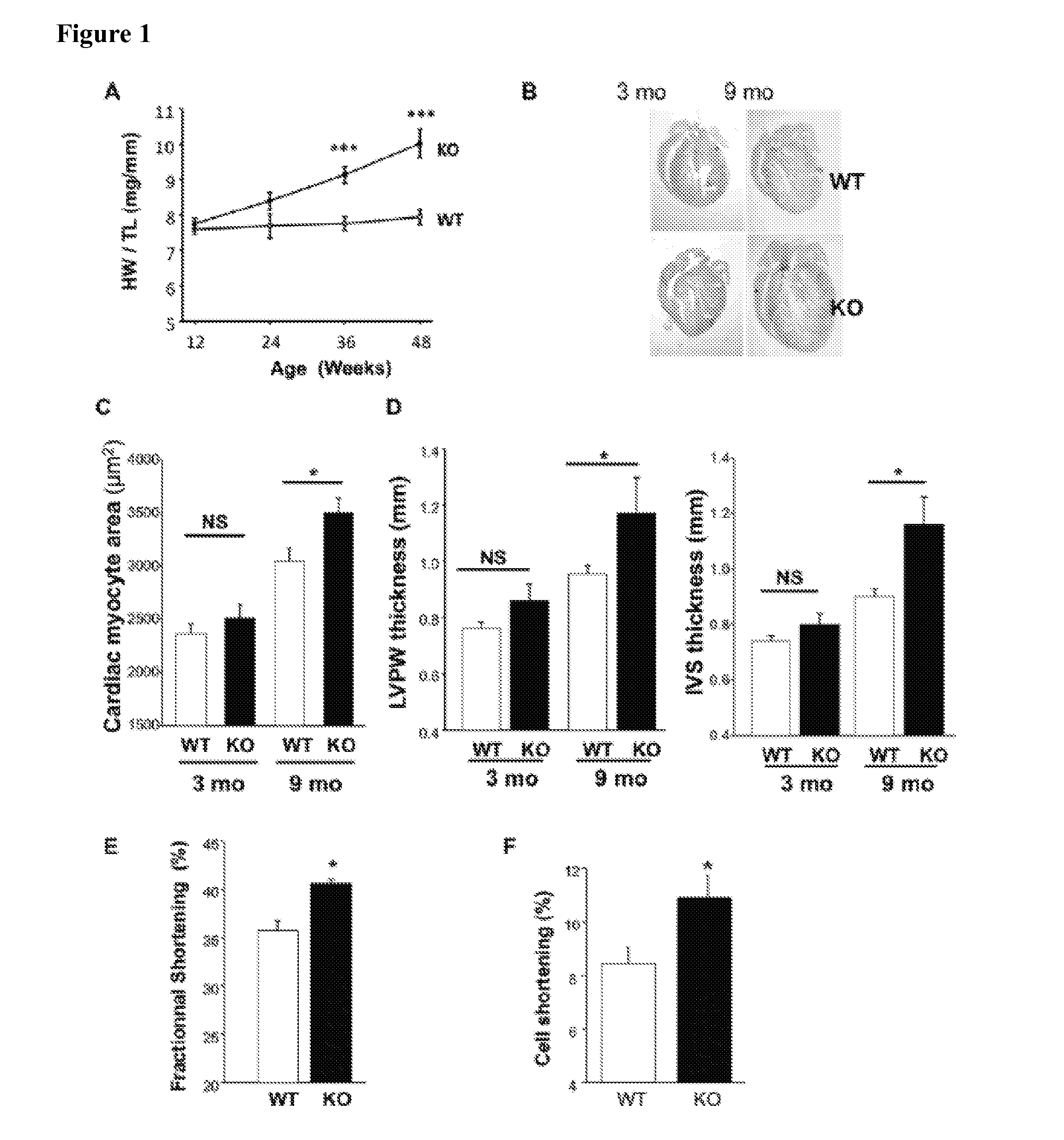 Inhibitors of MRP4 and Agents Stimulating MRP4 Activity for the Treatment of Cardiac Disorders