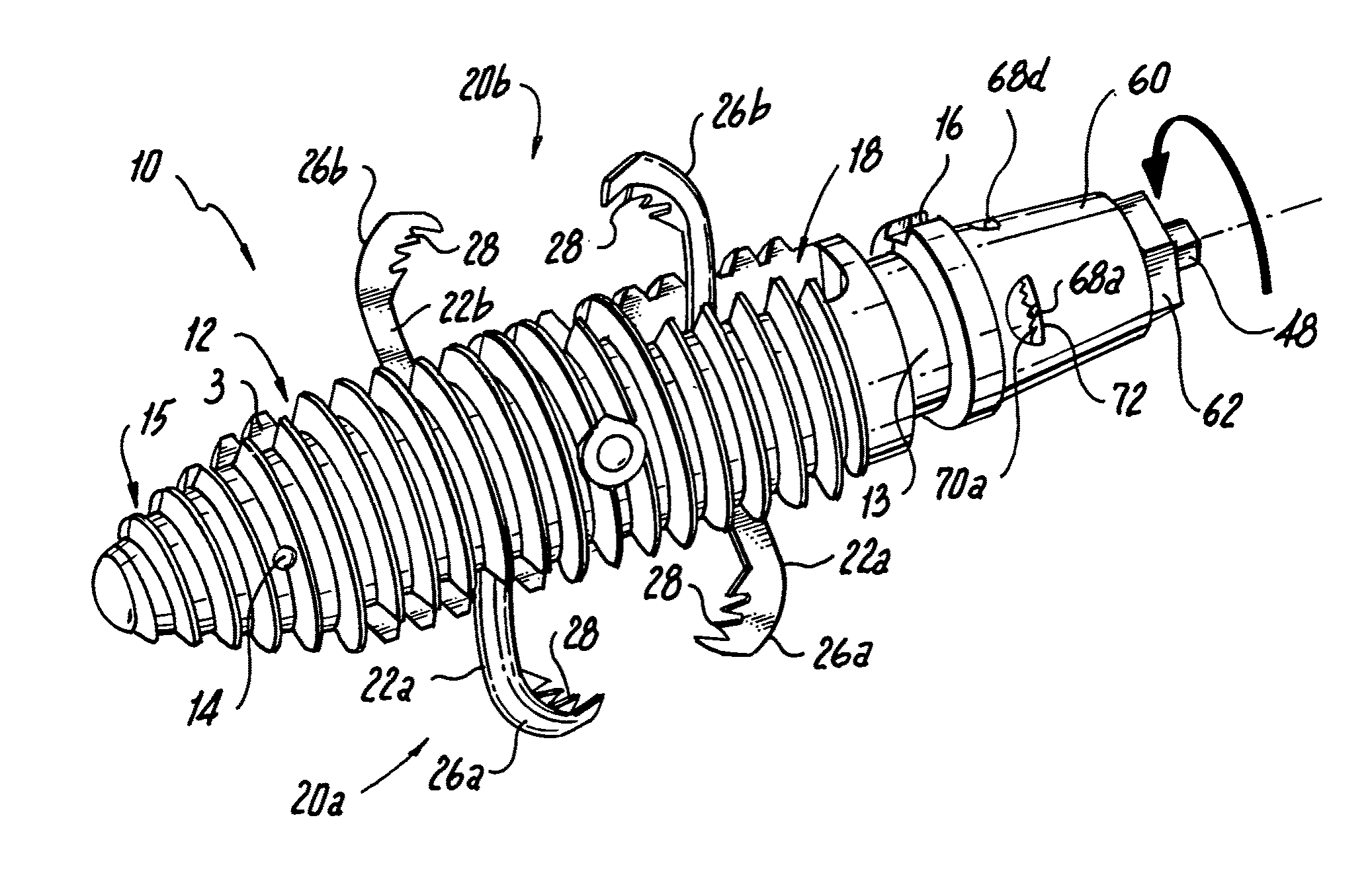 Interspinous process implants having deployable engagement arms