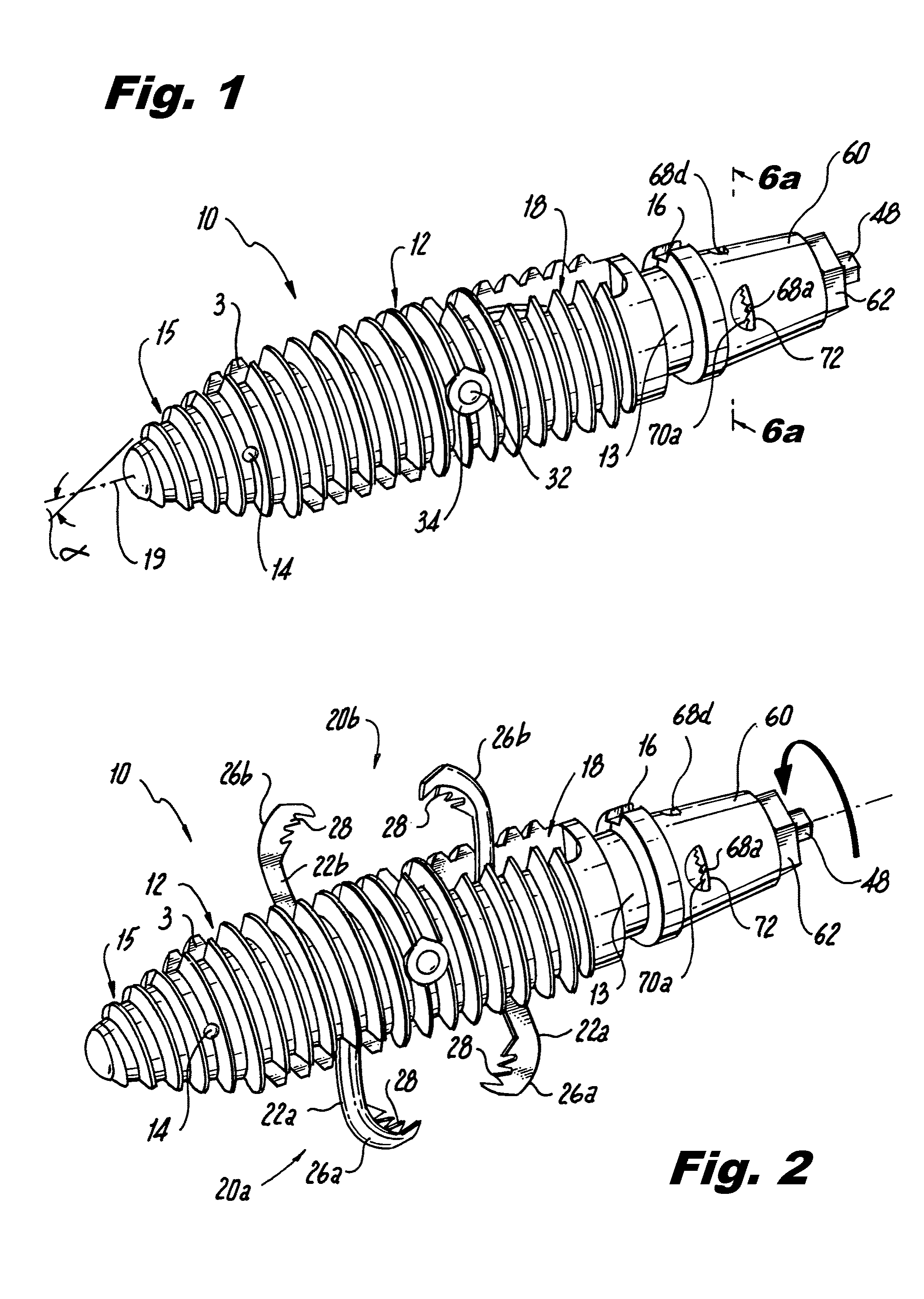 Interspinous process implants having deployable engagement arms