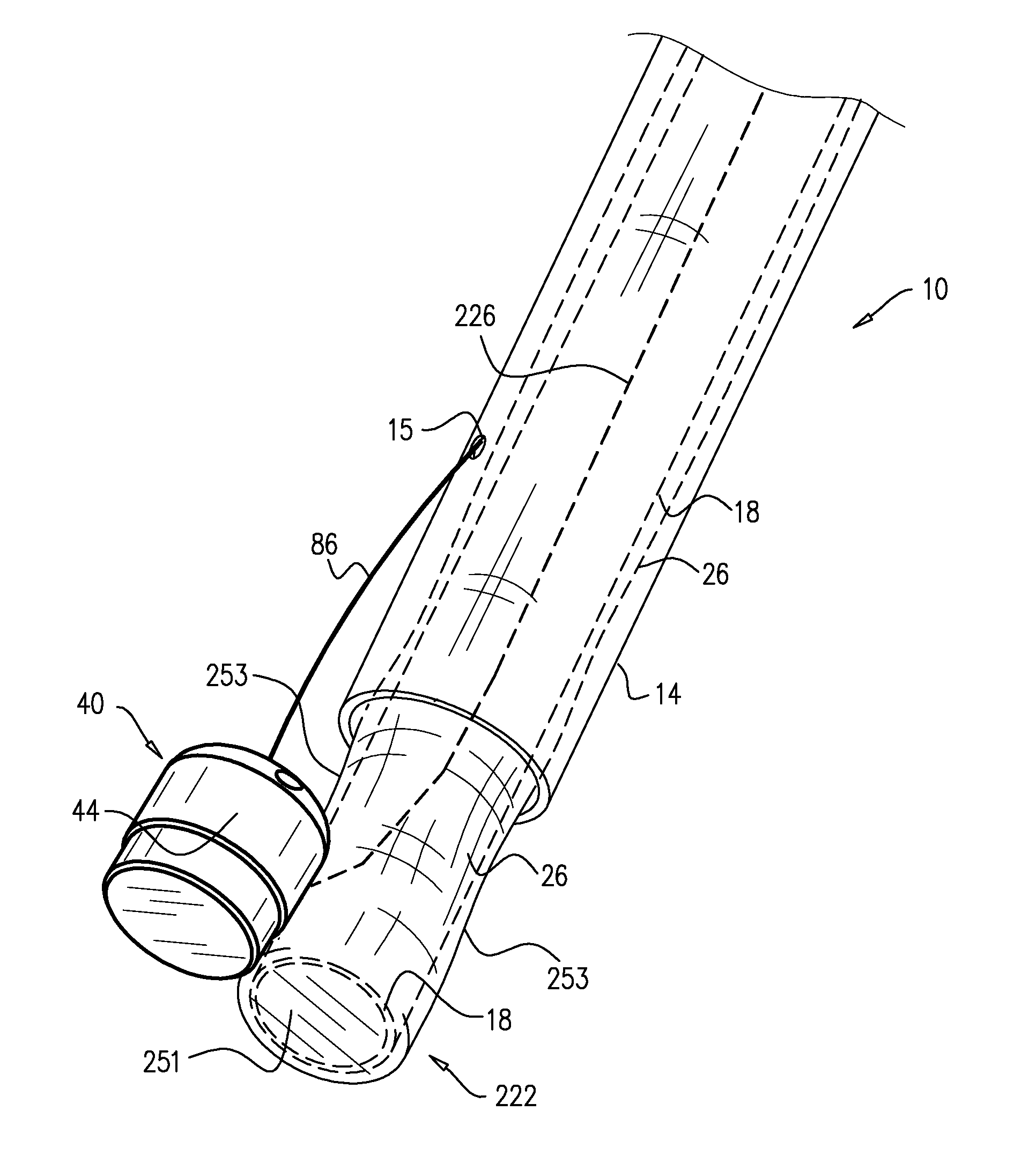 Implantation of flexible implant