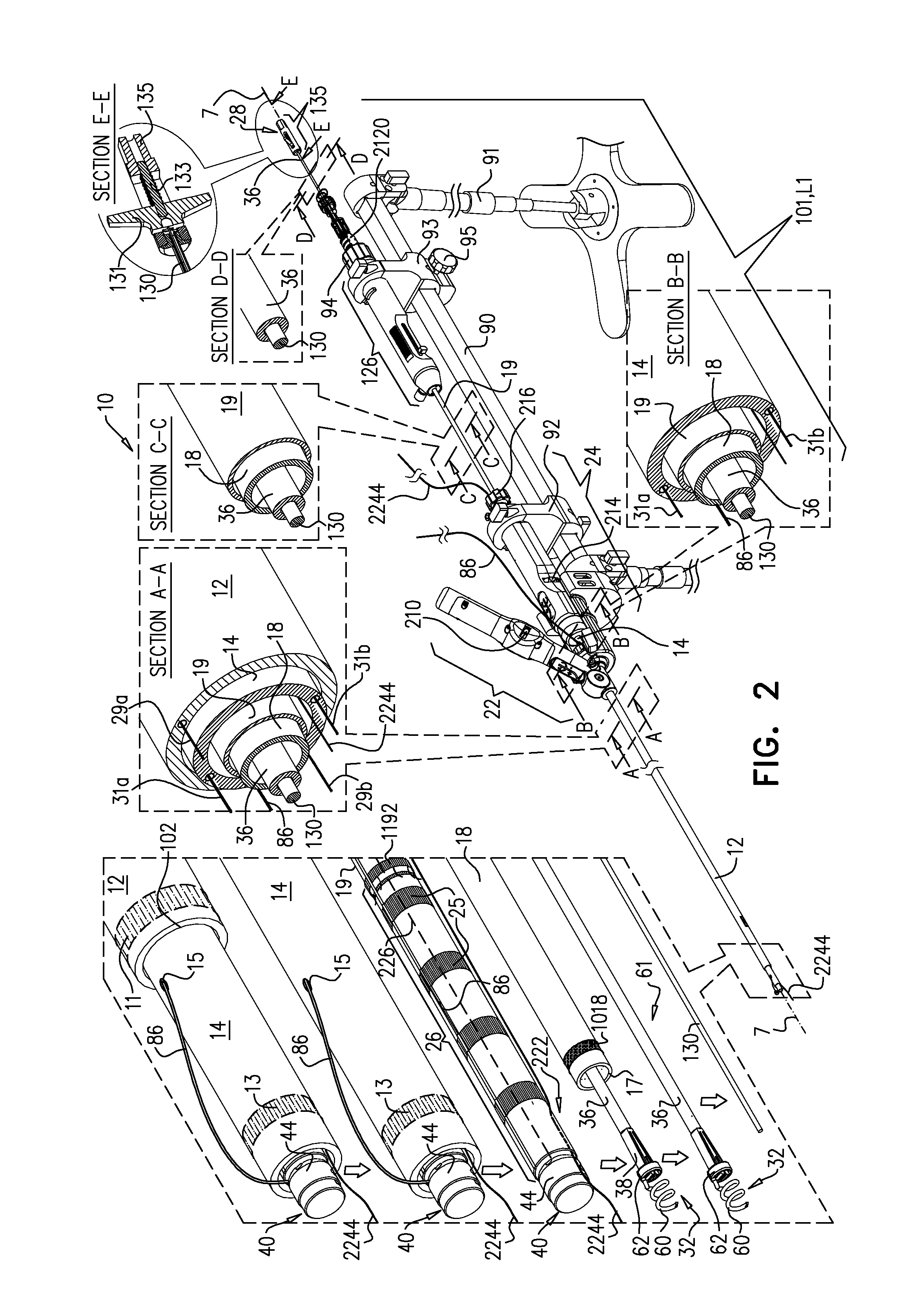 Implantation of flexible implant