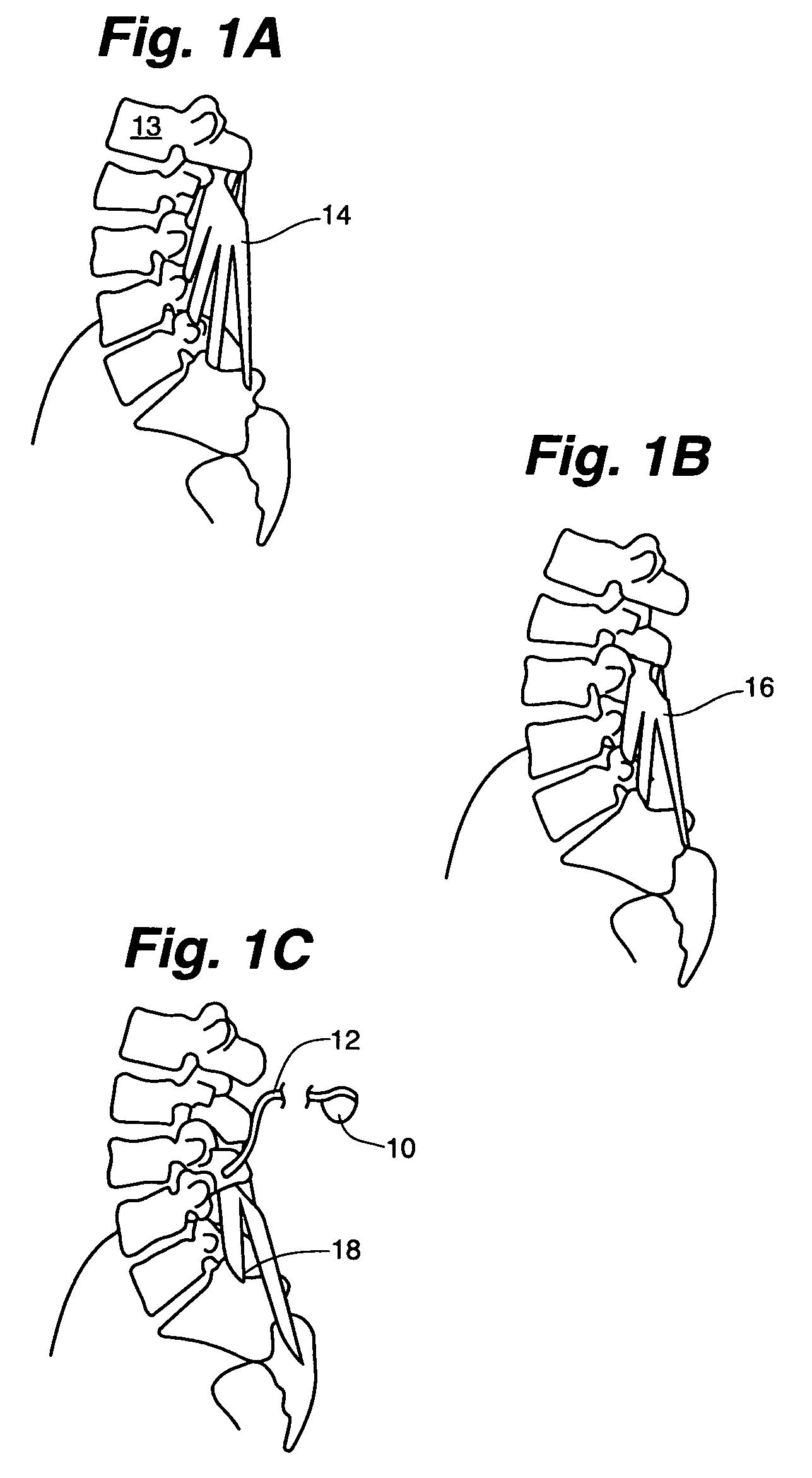 Muscle stimulator