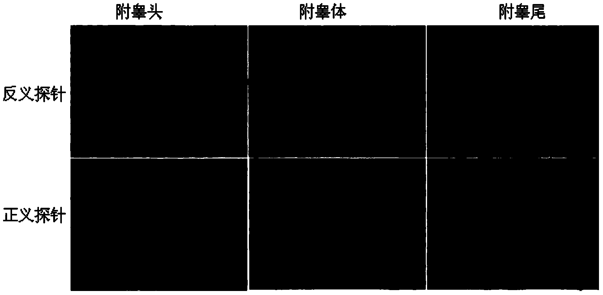 Interference fragment of colipase-like 2 (Clpsl2) gene and application of interference fragment