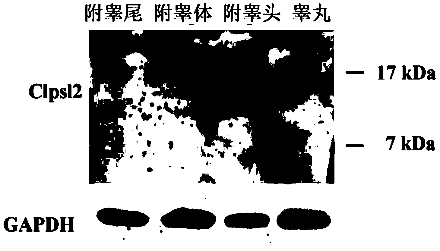 Interference fragment of colipase-like 2 (Clpsl2) gene and application of interference fragment