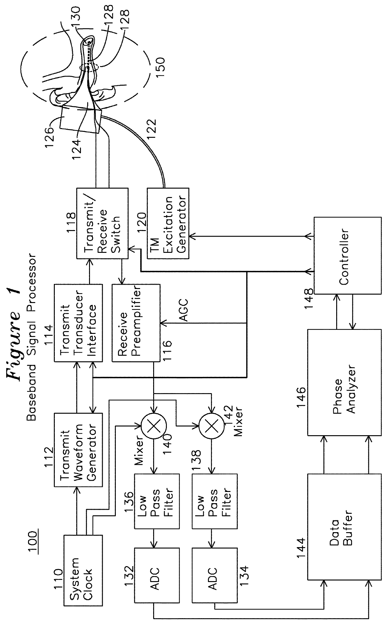 Apparatus and method for characterization of acute otitis media