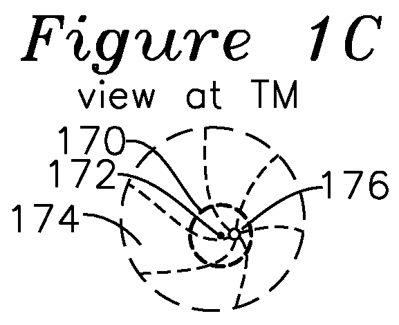 Apparatus and method for characterization of acute otitis media