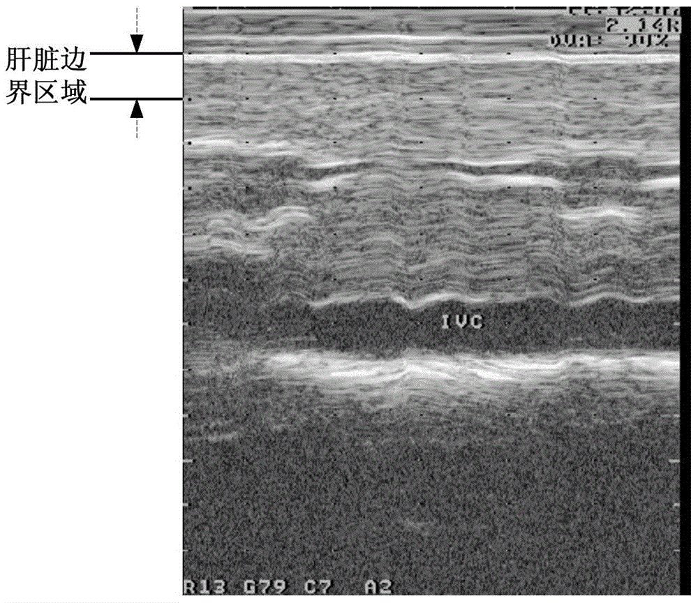 Liver boundary identification method and system