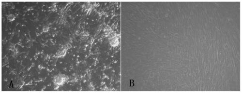 Live attenuated Japanese encephalitis vaccine strain sa14-14-2 adapted to human diploid cell 2bs and its vaccine