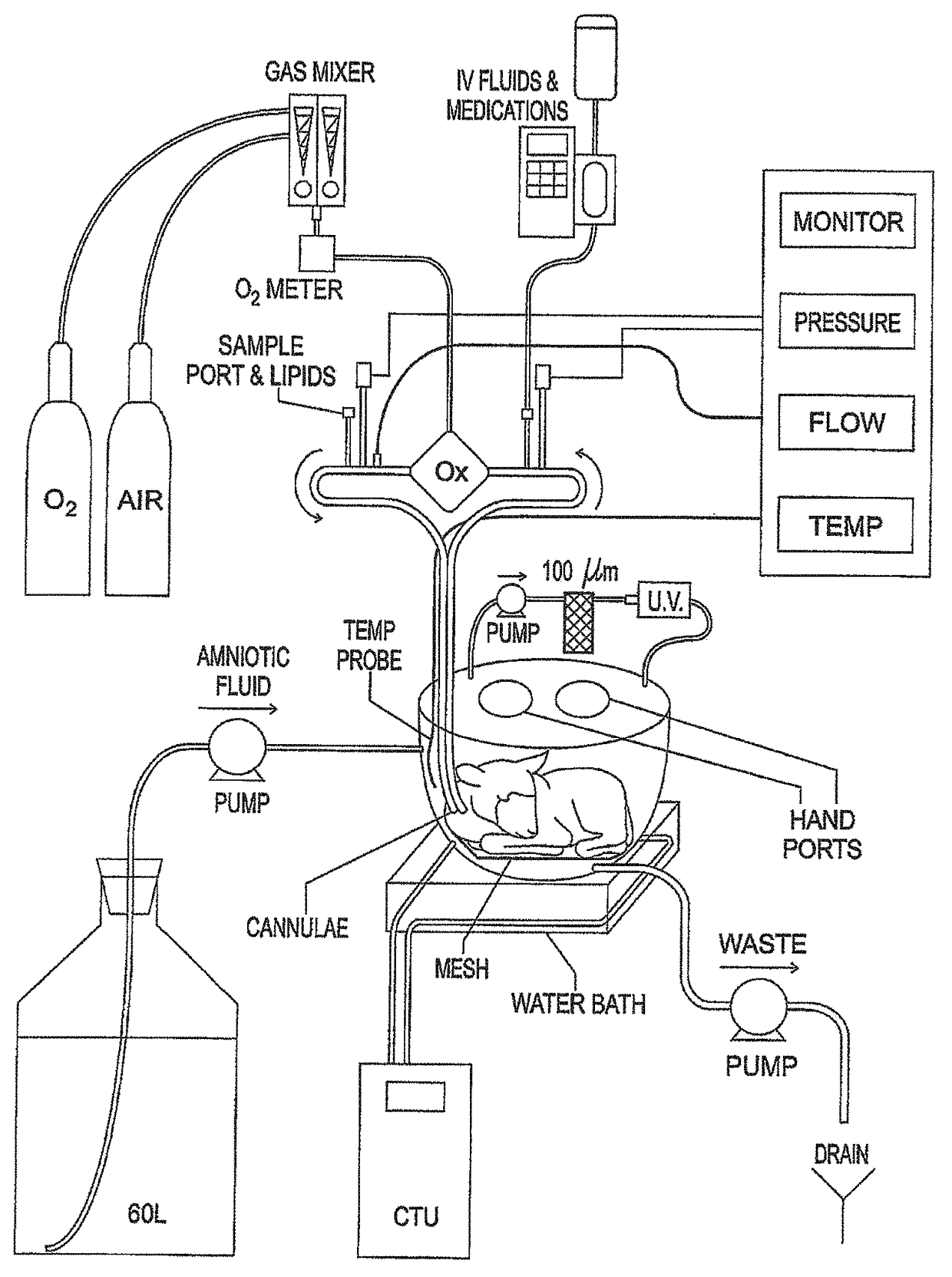 Extracorporeal life support system and methods of use thereof