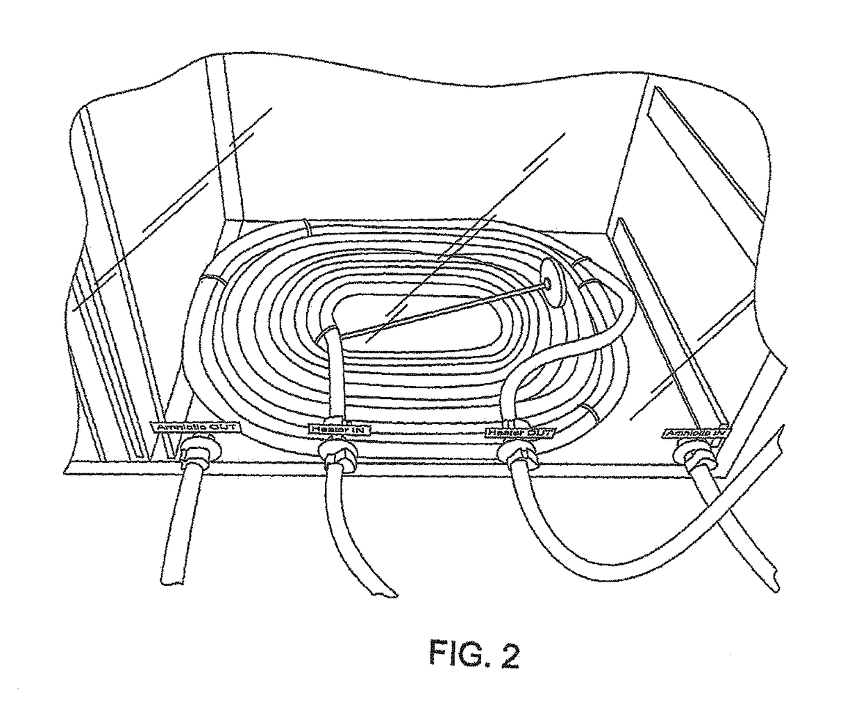 Extracorporeal life support system and methods of use thereof