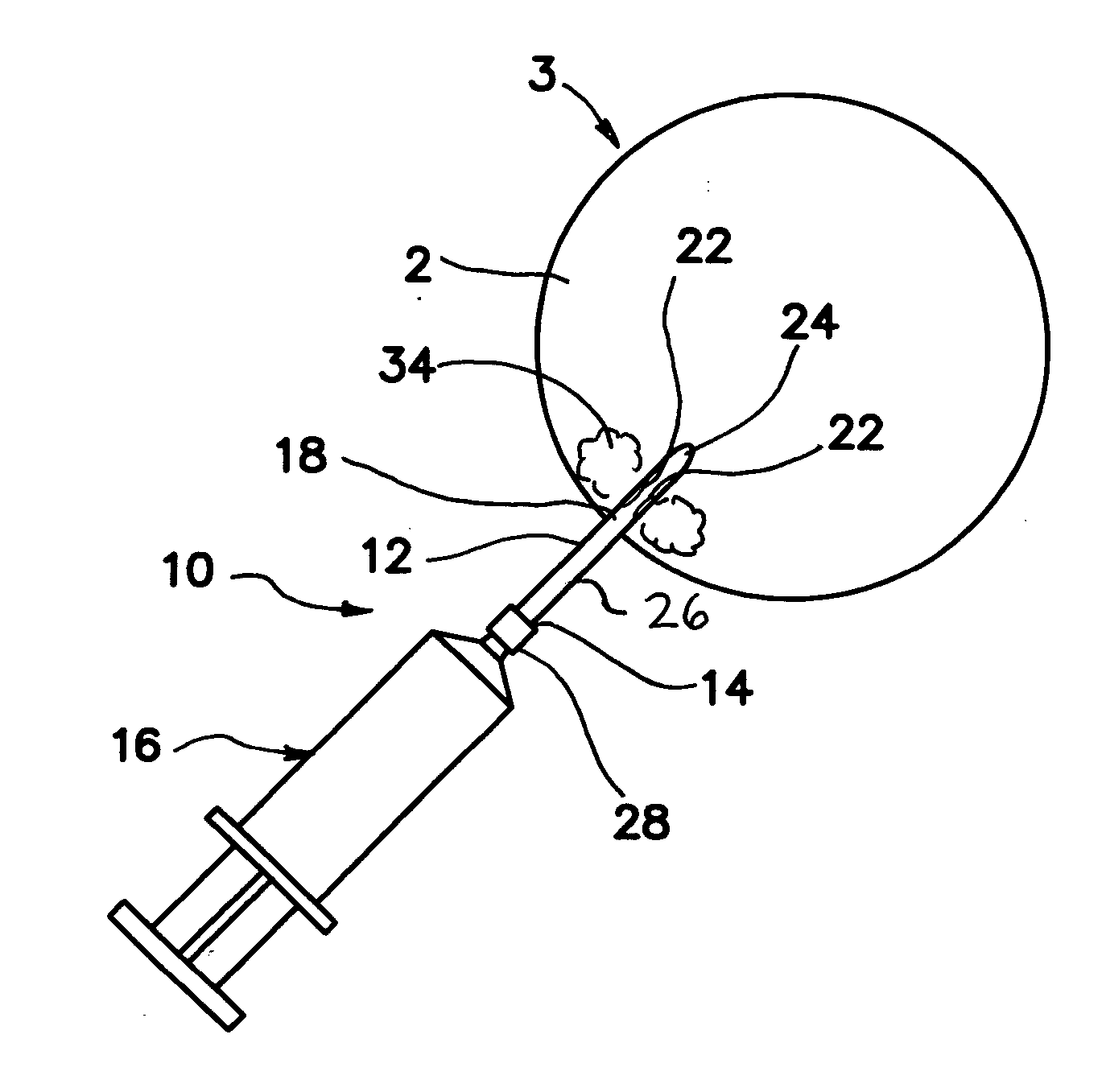 Apparatus and methods useful for intravitreal injection of drugs