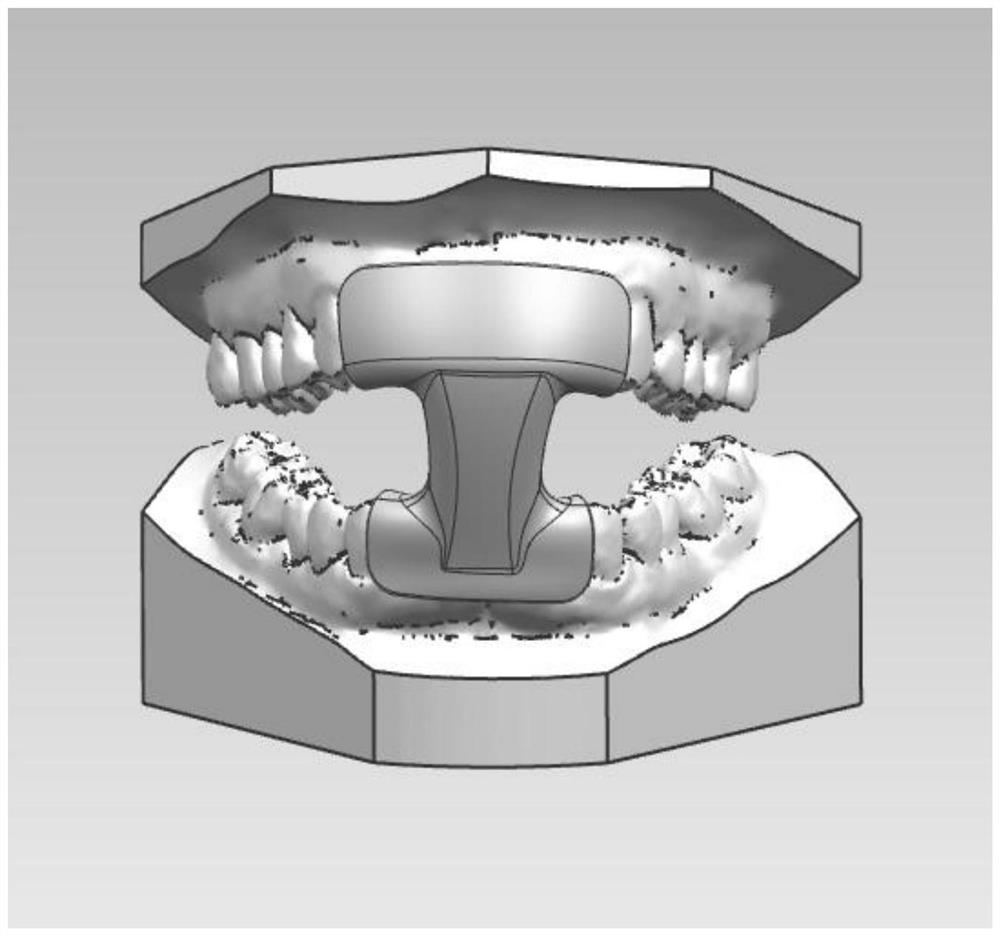 A kind of preparation method of universal anterior teeth mouth opener