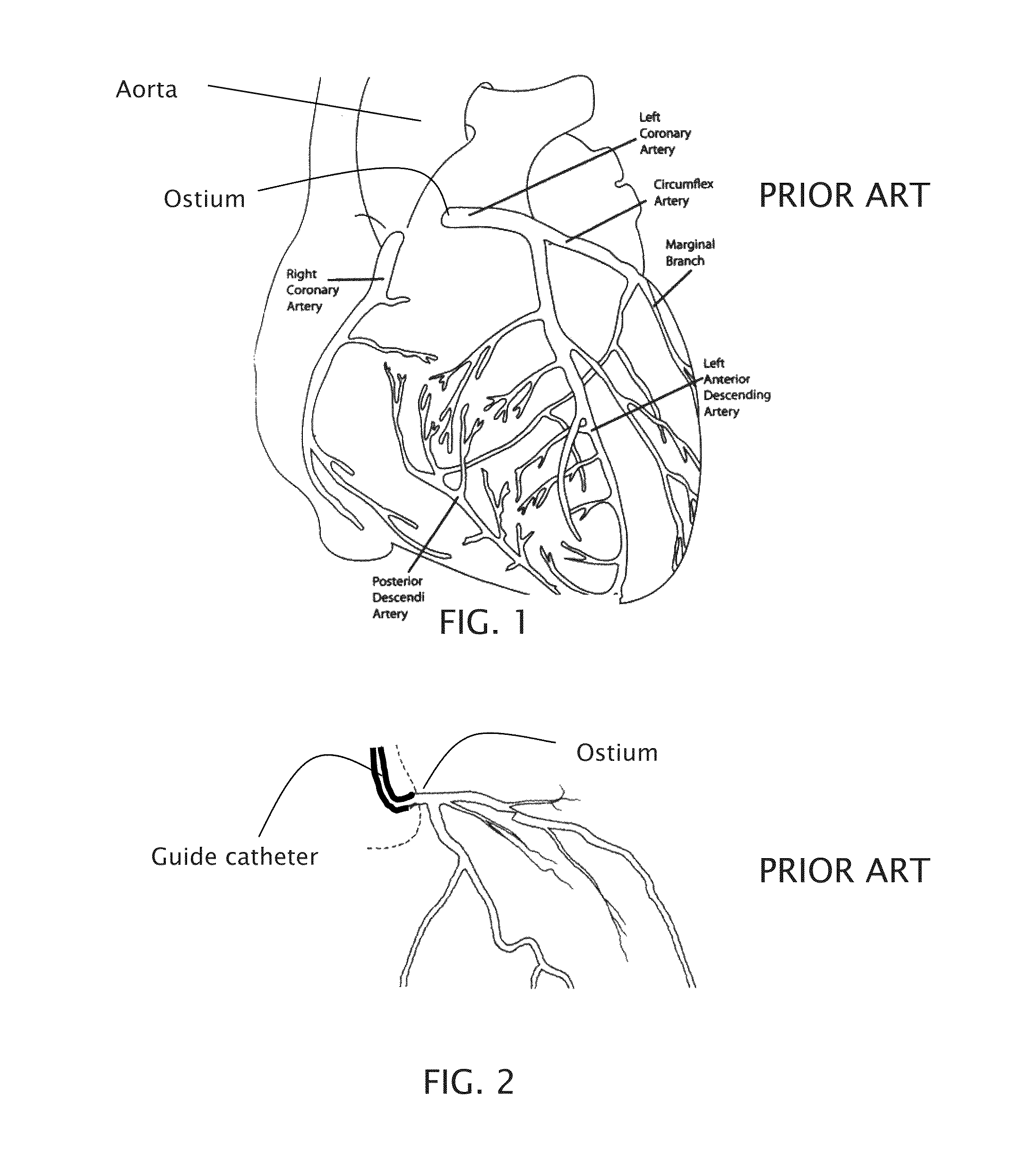 Cooling guide catheter and associated method of use