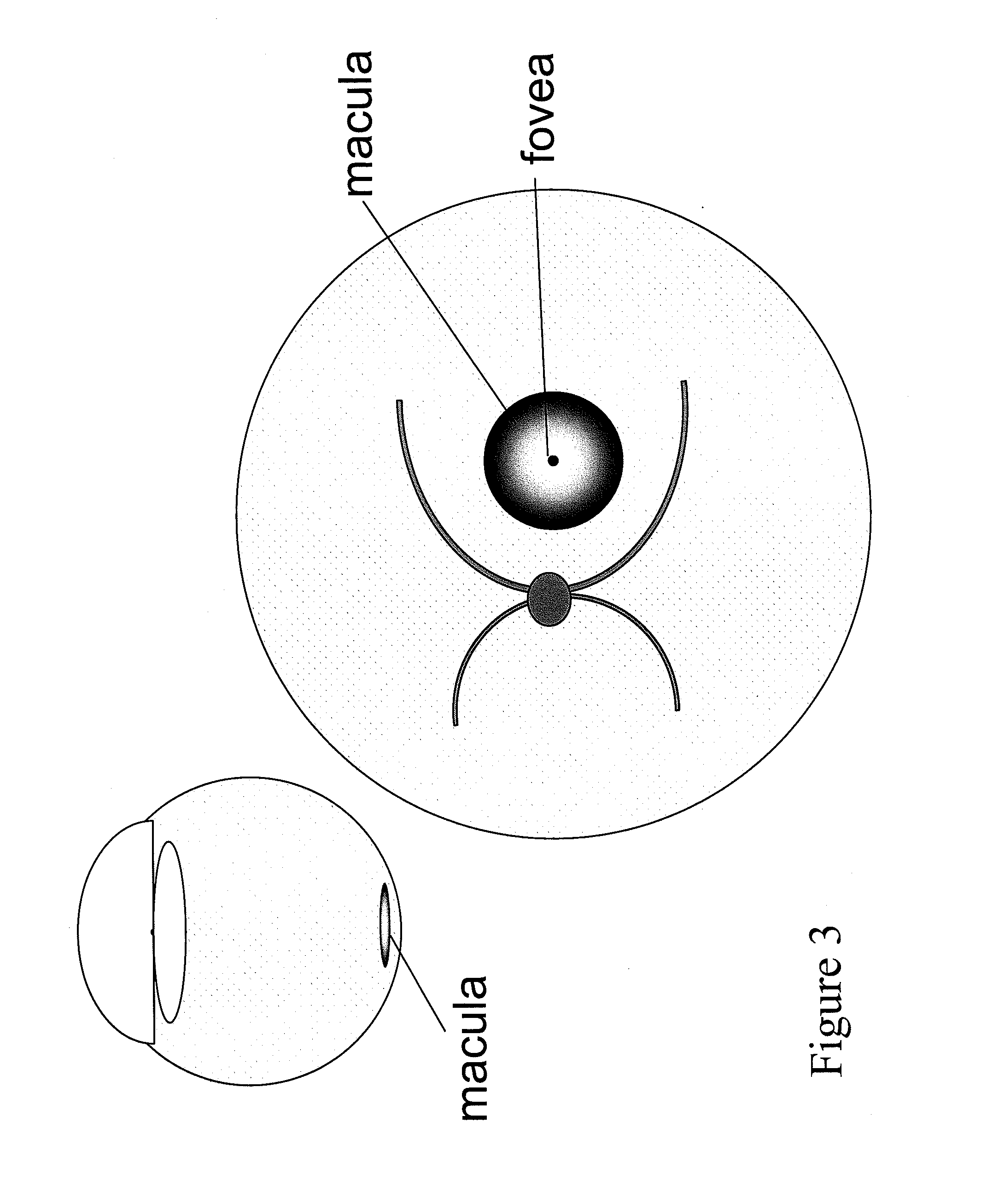 Devices and methods for delivering polynucleotides into retinal cells of the macula and fovea