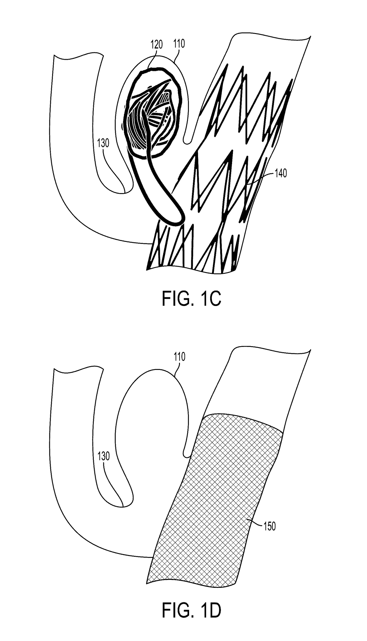 Geometry Based Method for Simulating Fluid Flow Through Heterogeneous Porous Media