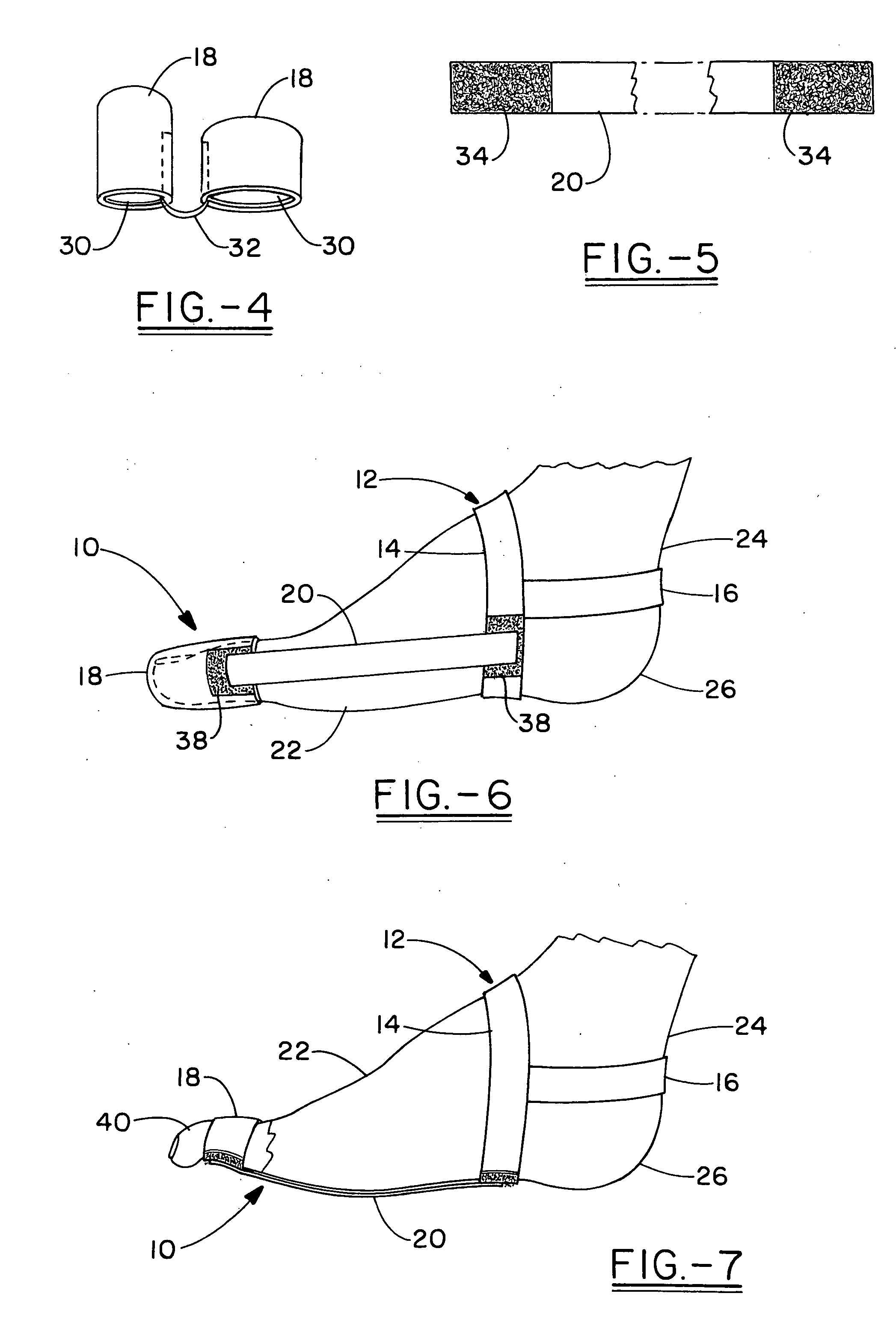 Therapeutic foot appliance and method of use