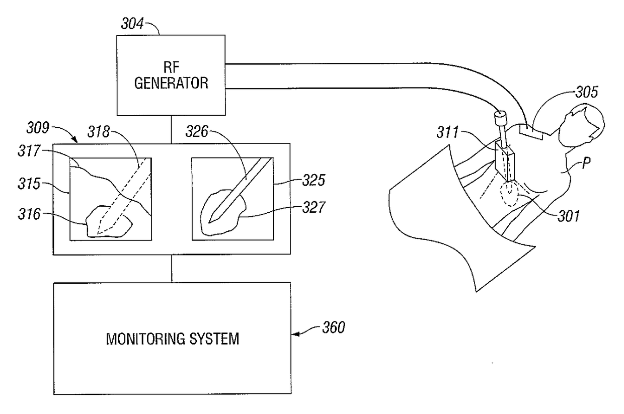 Method for volume determination and geometric reconstruction