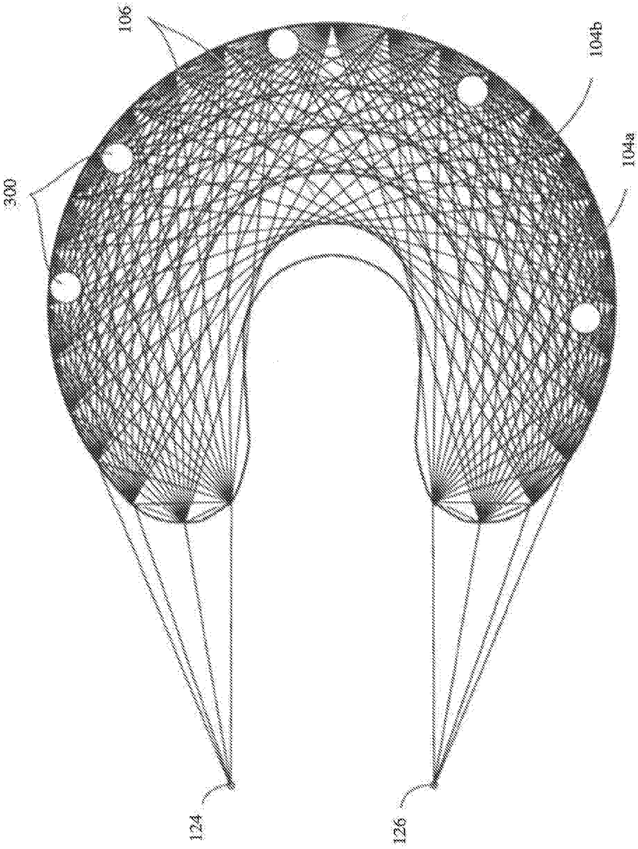 System and method for making personalized fibrocartilage implants