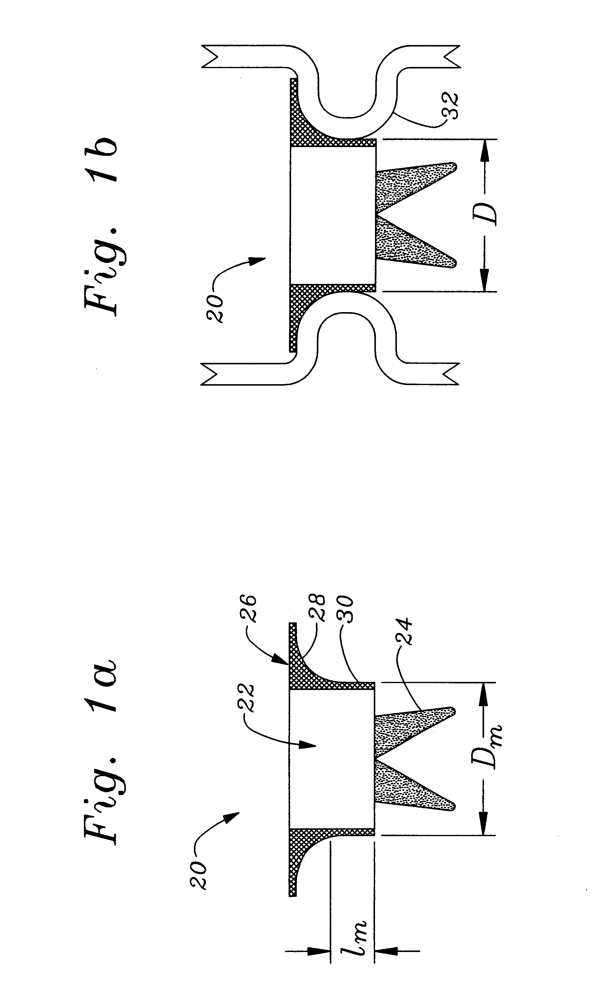 Combination anatomical orifice sizer and heart valve