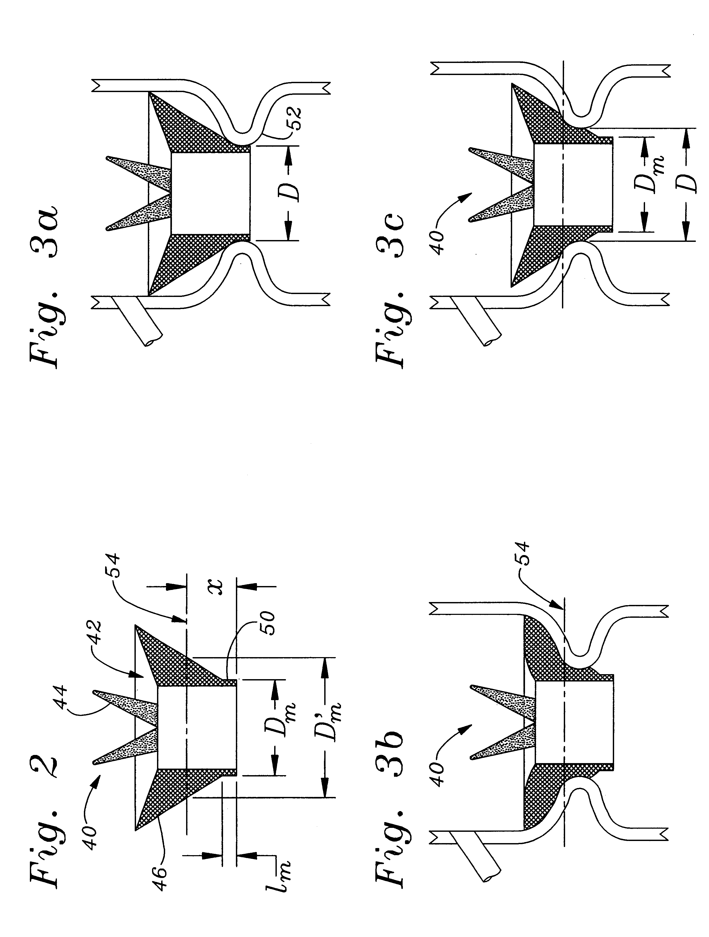 Combination anatomical orifice sizer and heart valve