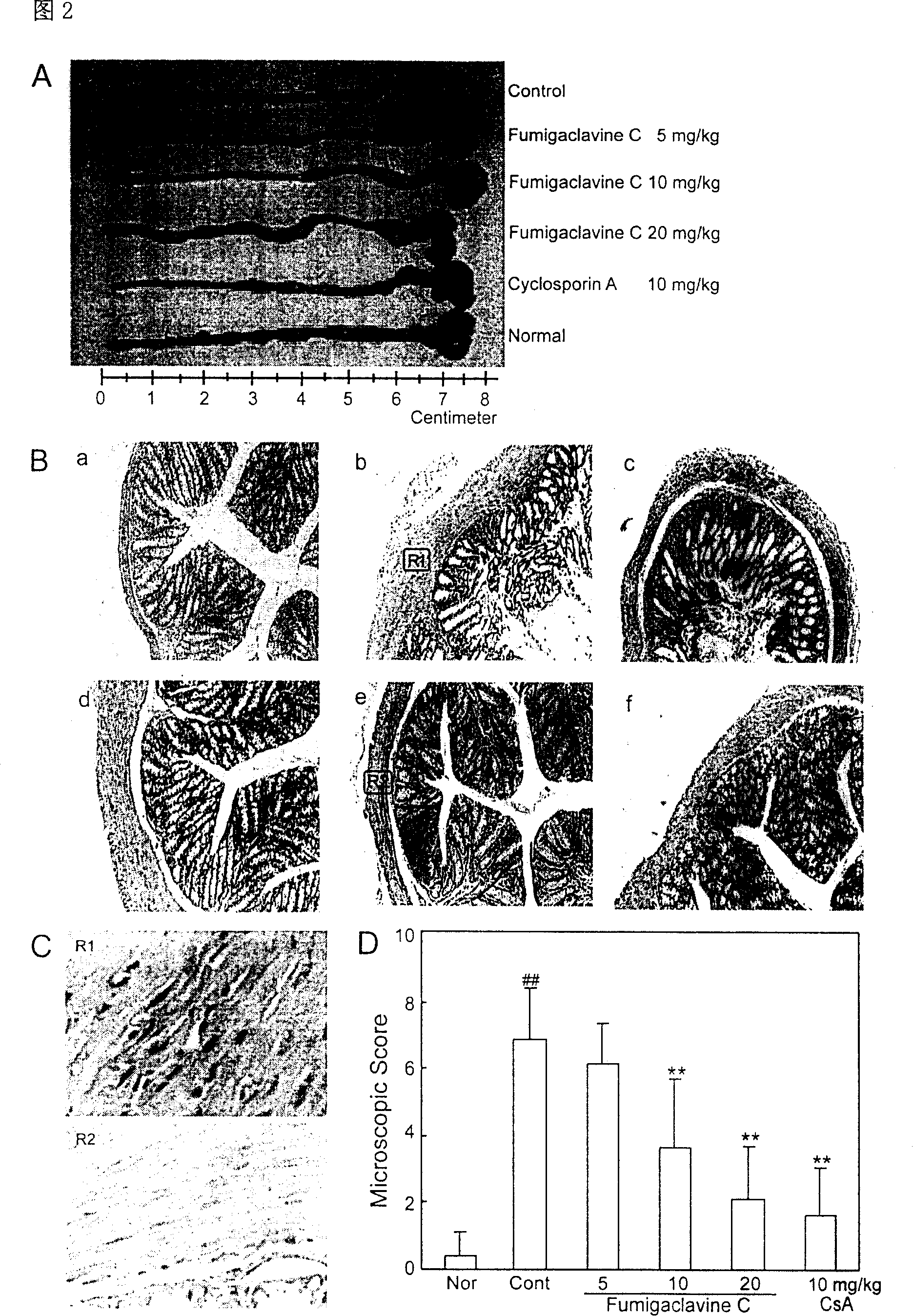 Application of fugillin in treating immunity entiritis and related immunity disease