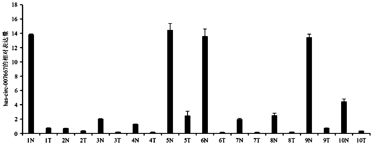 circRNA marker associated with early diagnosis of colorectal cancer, detection primer, reagent kit and application of circRNA marker