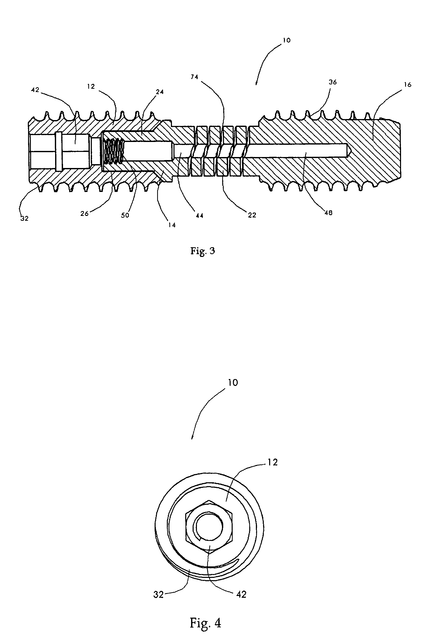 Spinal mobility preservation apparatus