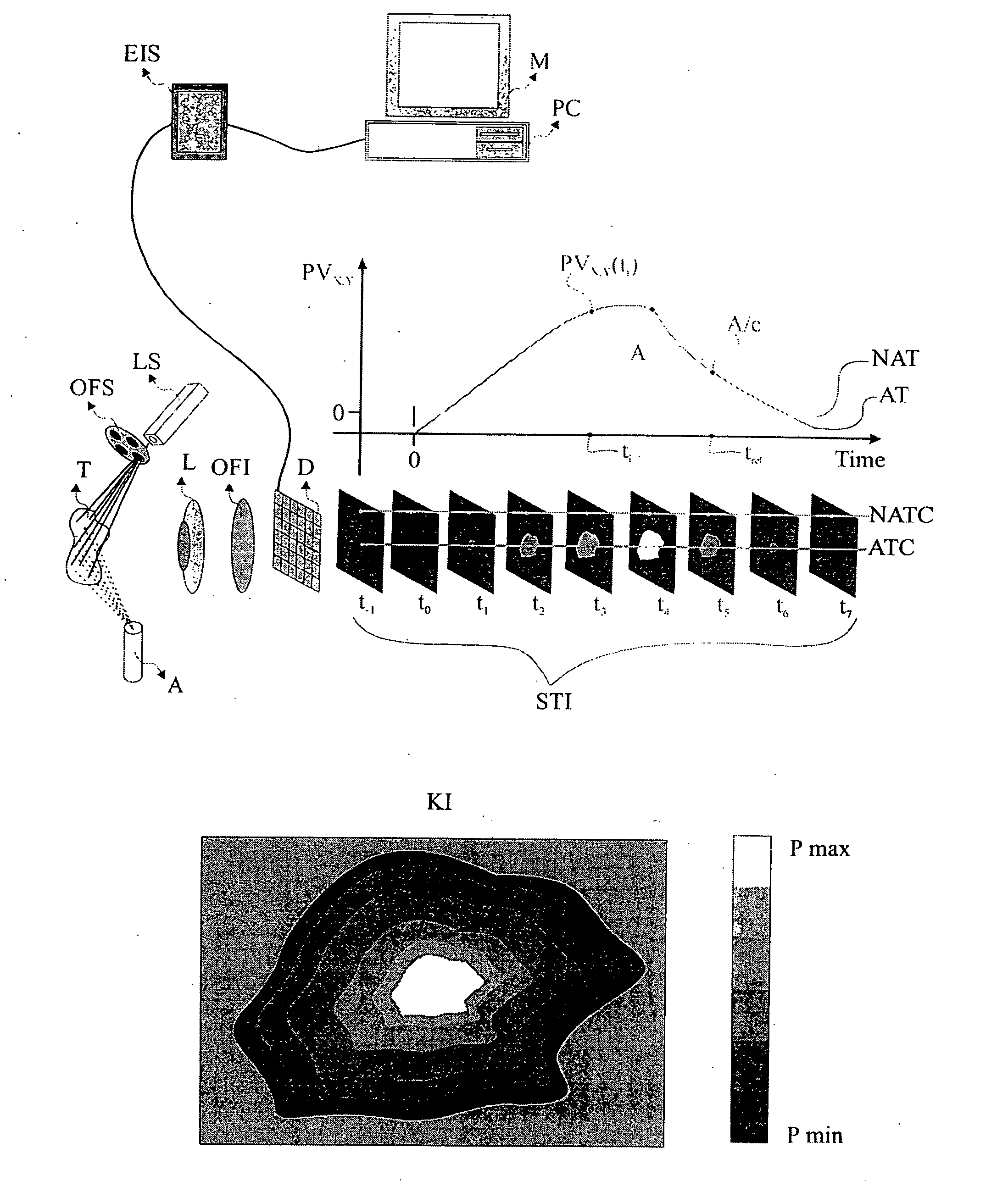 Method and system for characterization and mapping of tissue lesions