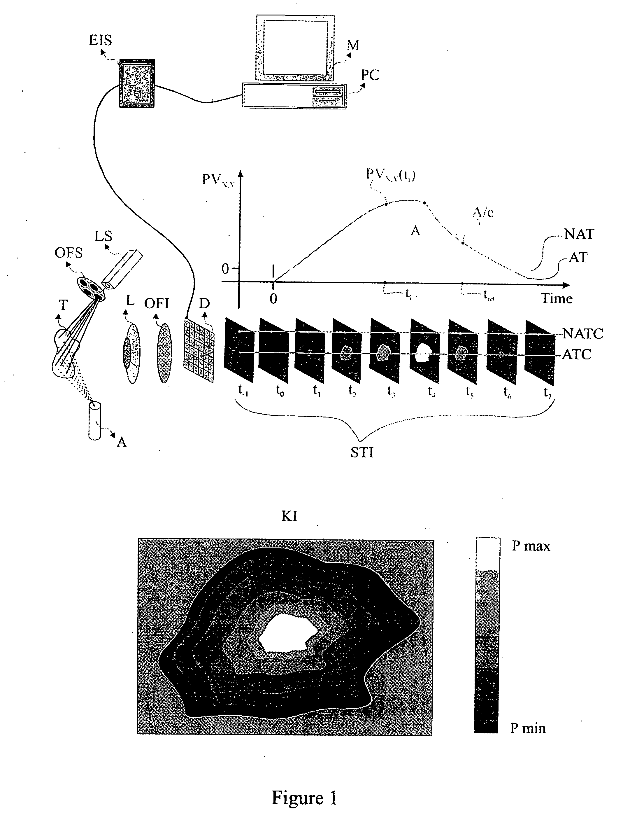 Method and system for characterization and mapping of tissue lesions