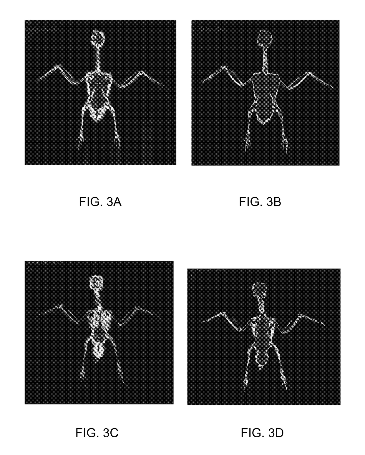 Radiograph density detection device