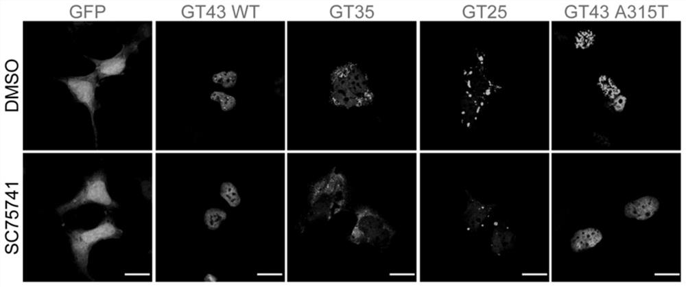 Application of c-Abl inhibitor in preparation of medicine for preventing and/or treating amyotrophic lateral sclerosis