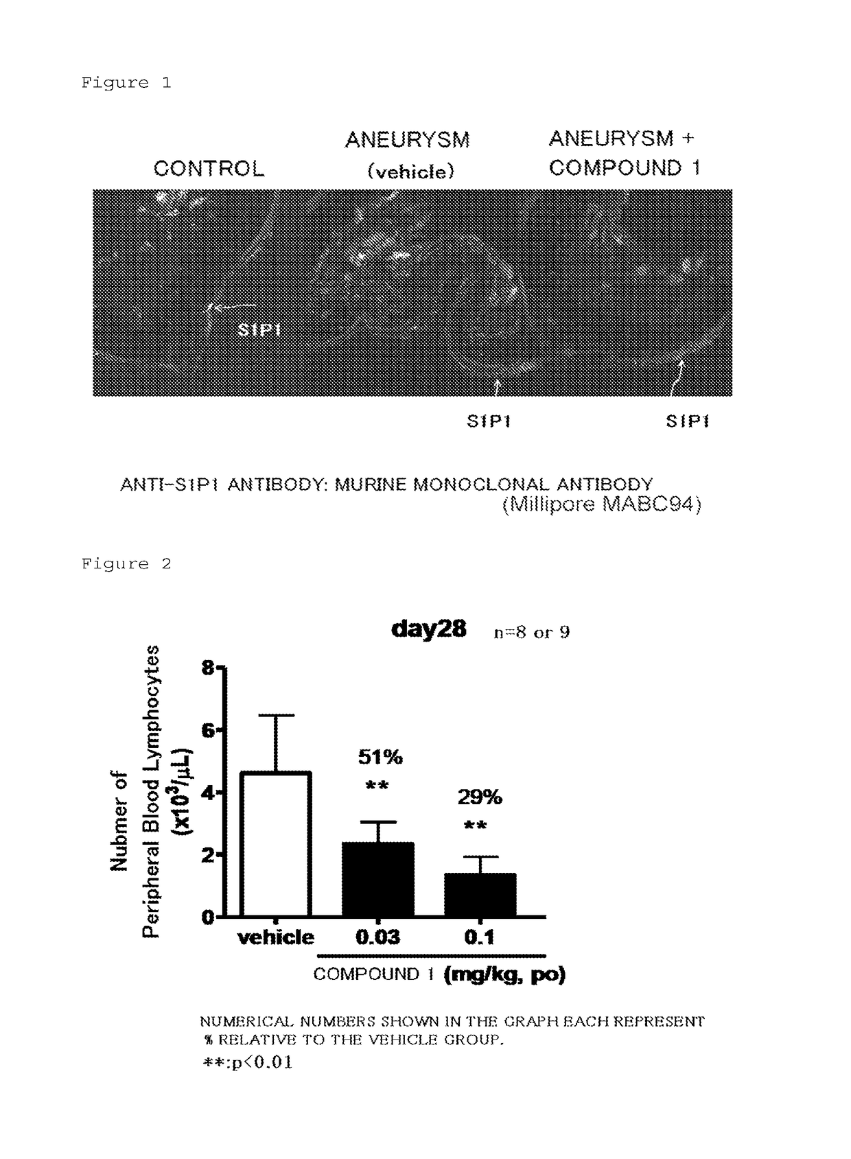 Medicinal composition for inhibiting formation and/or enlargement of cerebral aneurysm or shrinking same