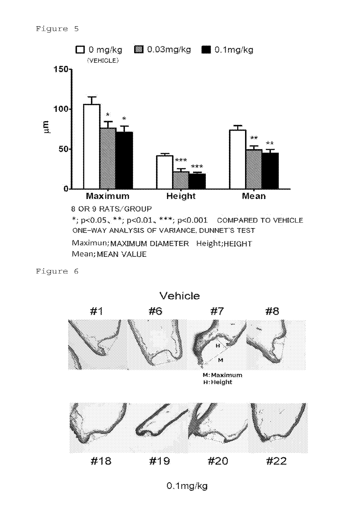 Medicinal composition for inhibiting formation and/or enlargement of cerebral aneurysm or shrinking same