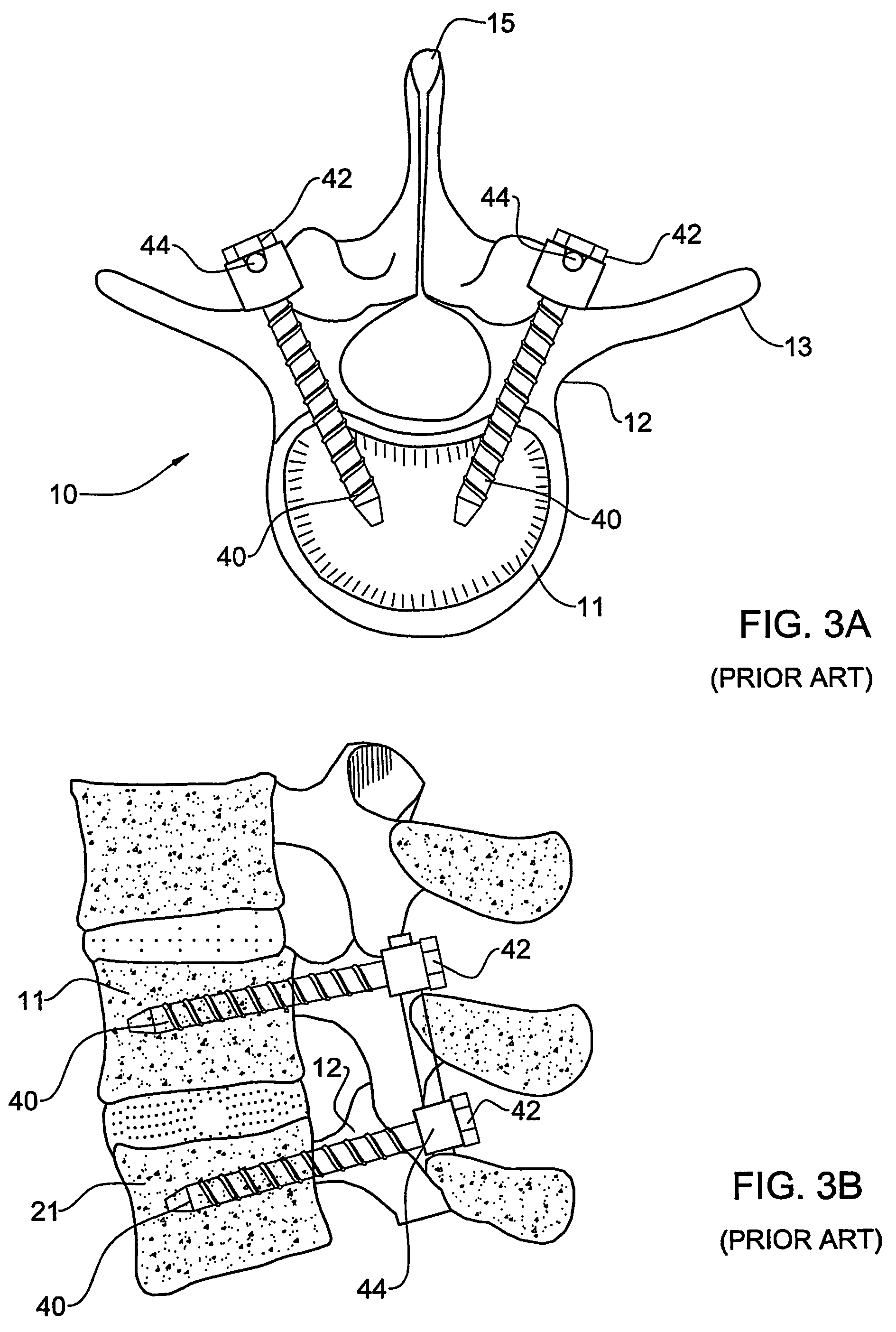 Orthopedic clamps