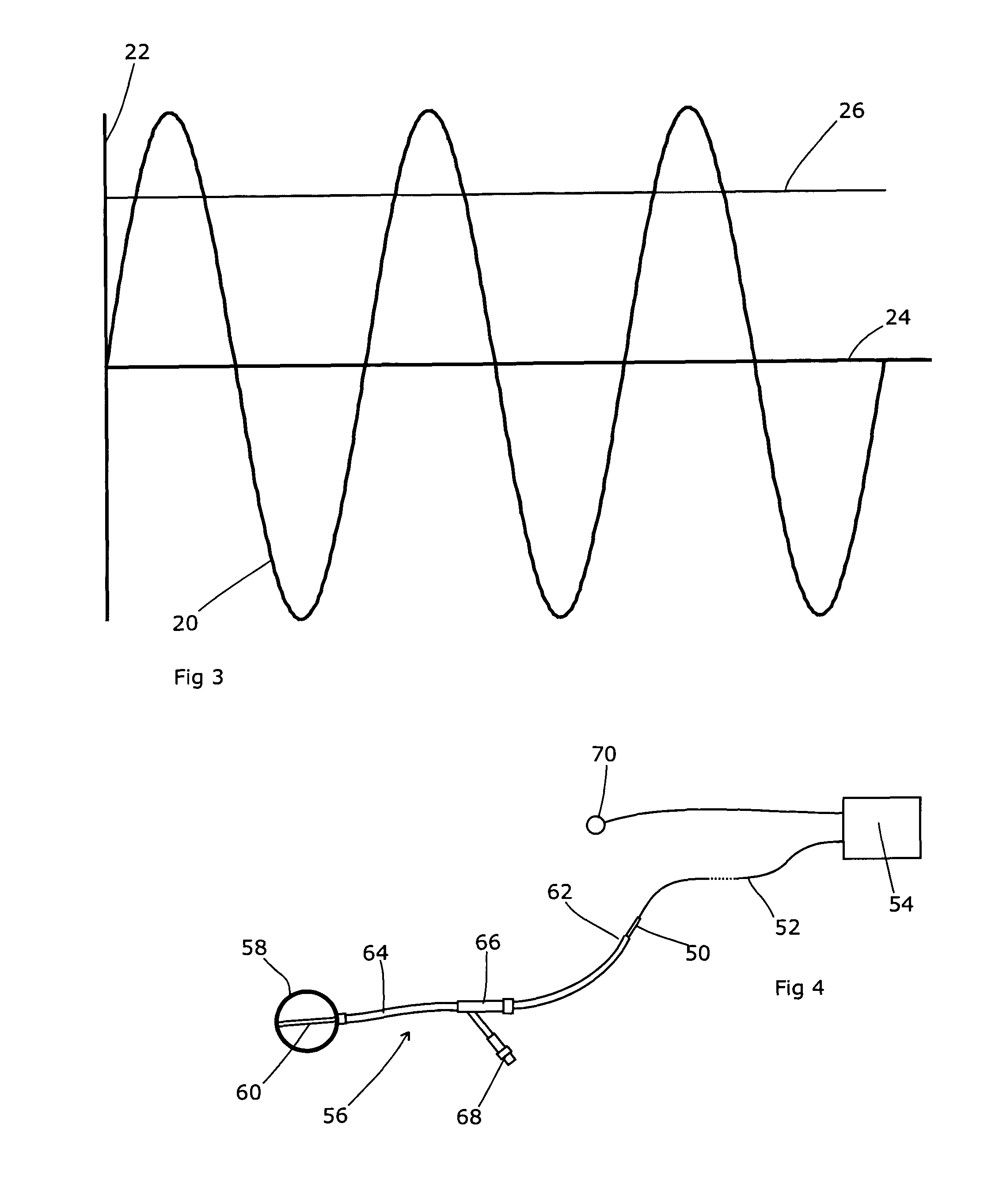 Apparatus for respiration state gated brachytherapy