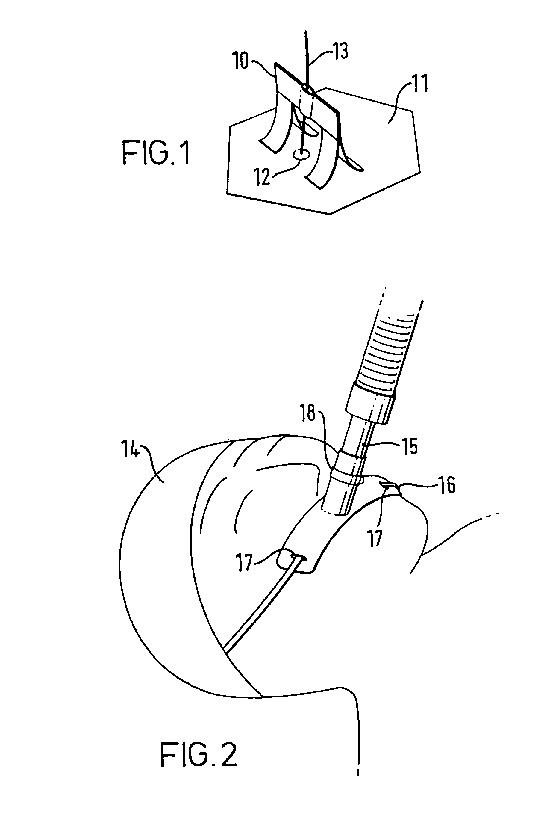 Method of securing a line to a patient, fasteners and their use to secure a line to a patient