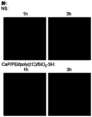 Nanoparticle carrier containing TLR3 ligand in PRRs (pattern recognition receptors) as well as preparation method and application of nanoparticle carrier