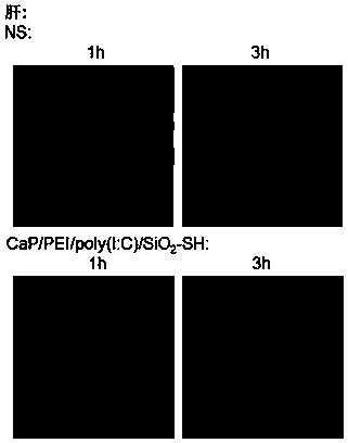 Nanoparticle carrier containing TLR3 ligand in PRRs (pattern recognition receptors) as well as preparation method and application of nanoparticle carrier