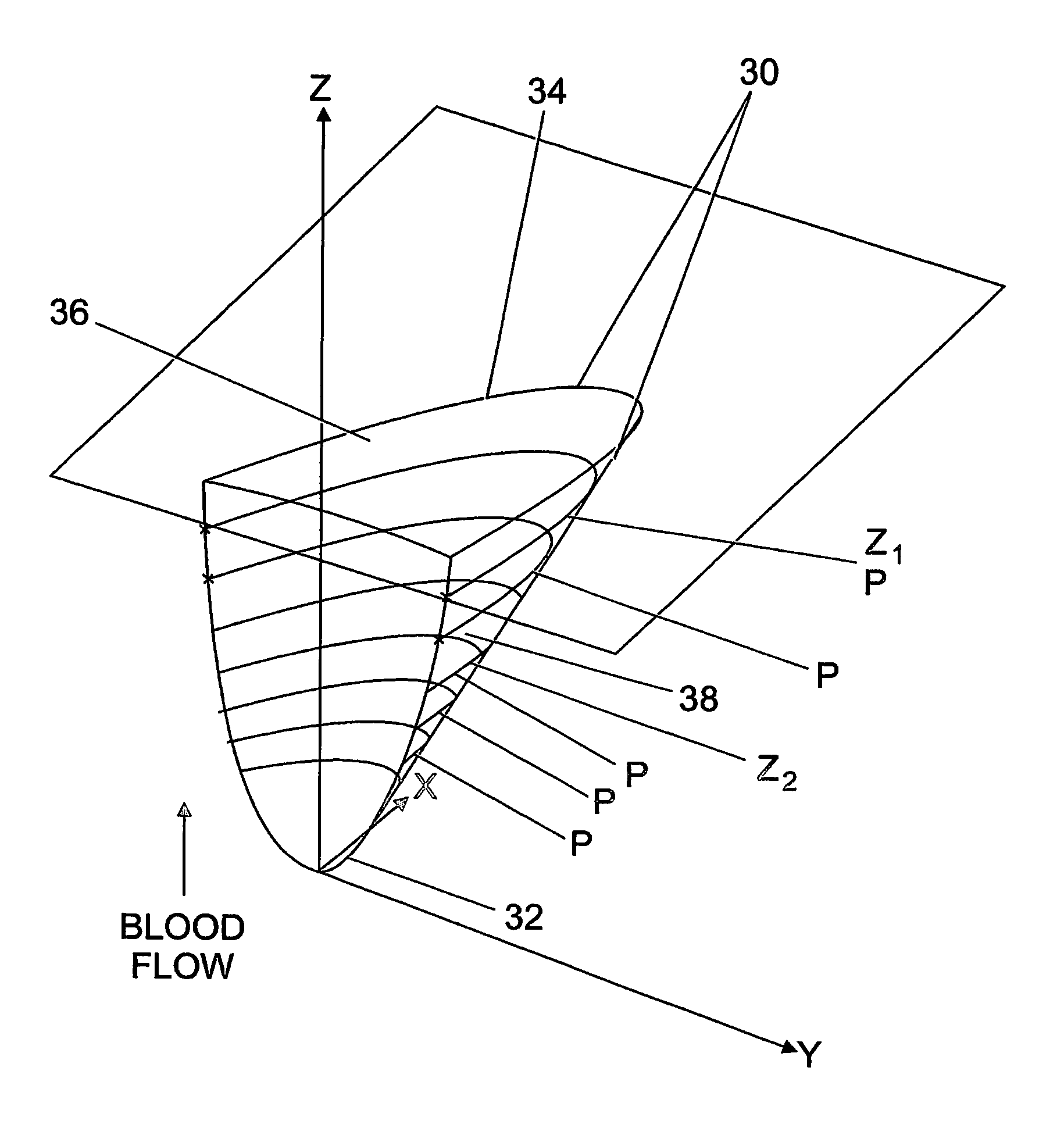 Cardiac valve featuring a parabolic function