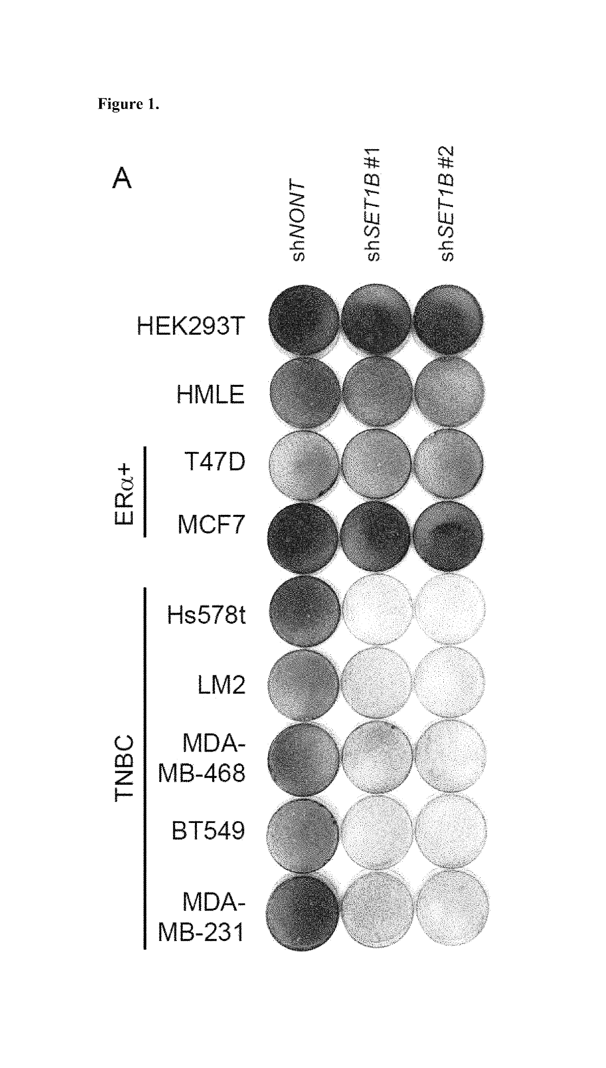 Therapeutic targeting of SET1B/compass pathway for treating cancers