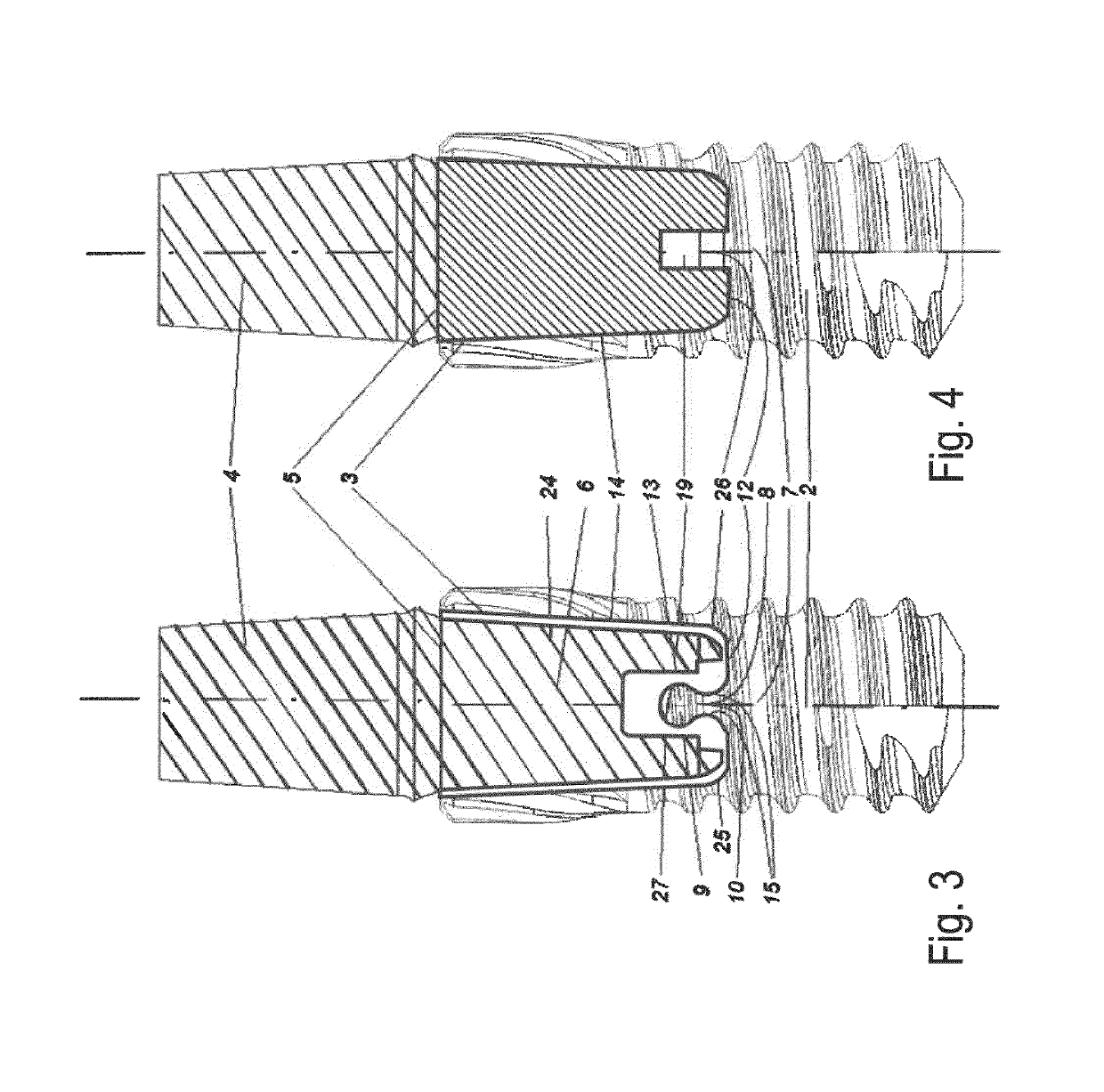 Dental insert for connecting a dental implant to a dental abutment