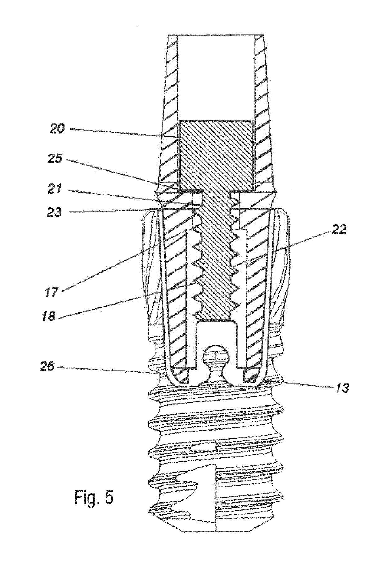 Dental insert for connecting a dental implant to a dental abutment