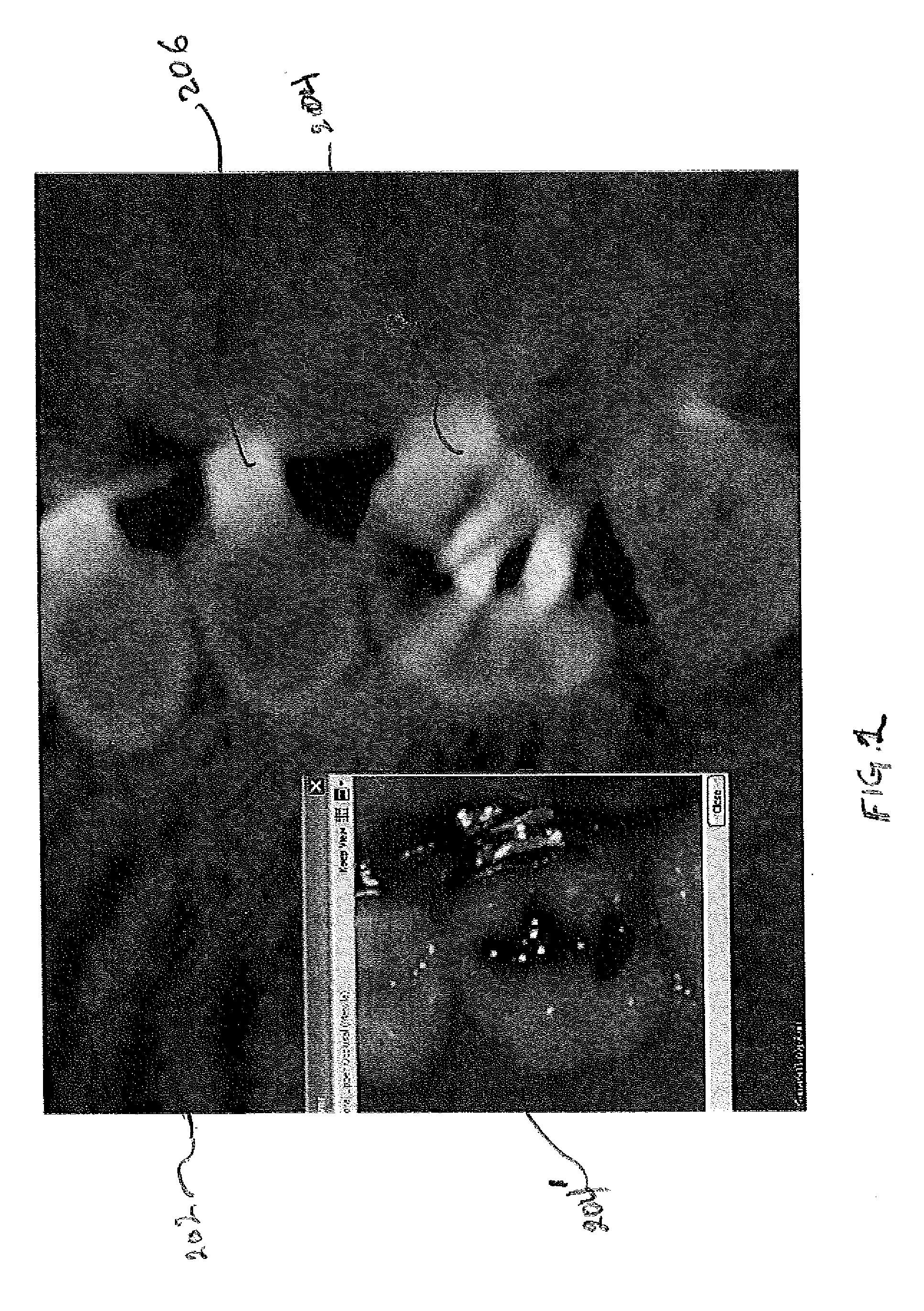 Generating three dimensional digital dention models from surface and volume scan data